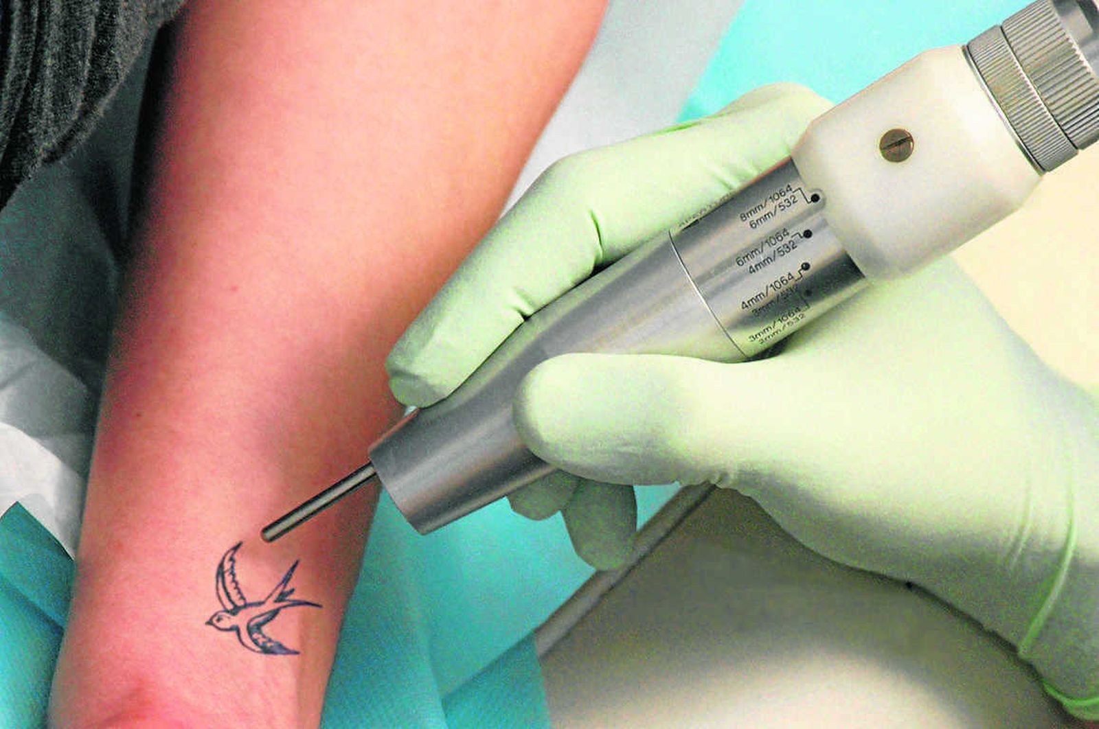 Aquellos que se arrepientan de haber dibujado su piel pueden recurrir al láser.