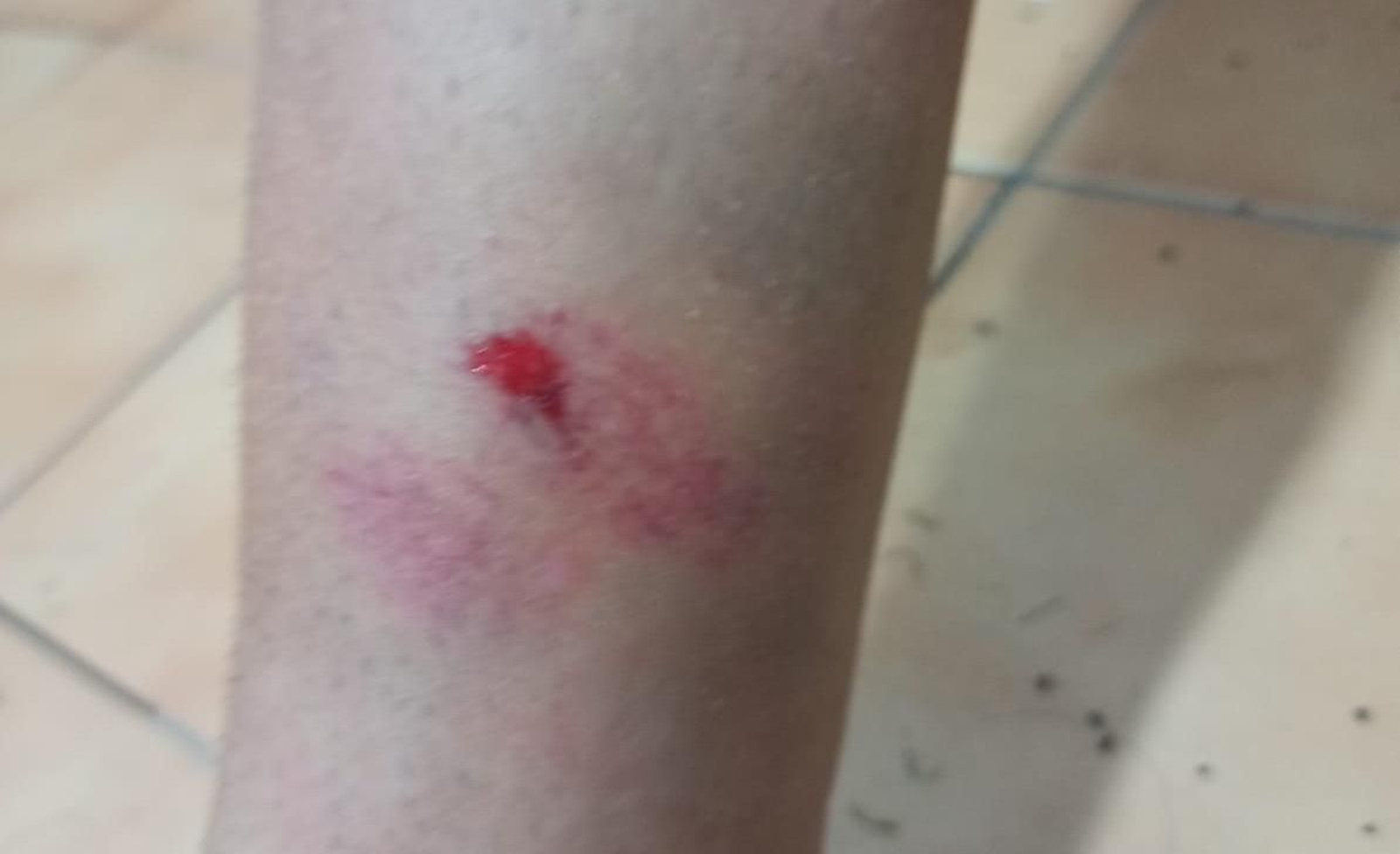 Juan Luna acabó con un fuerte golpe en la tibia.