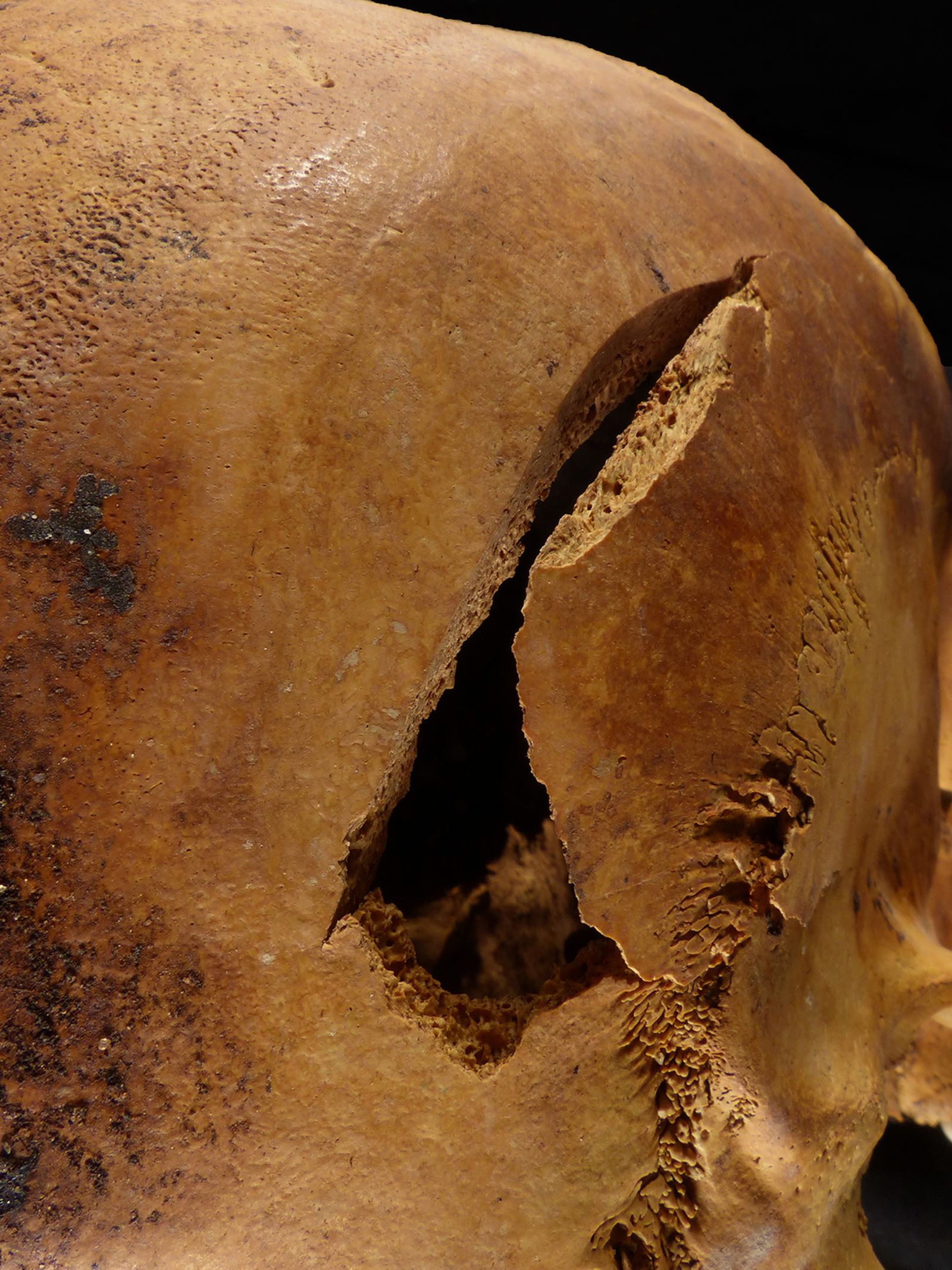 Cráneo encontrado en una de las tumbas.