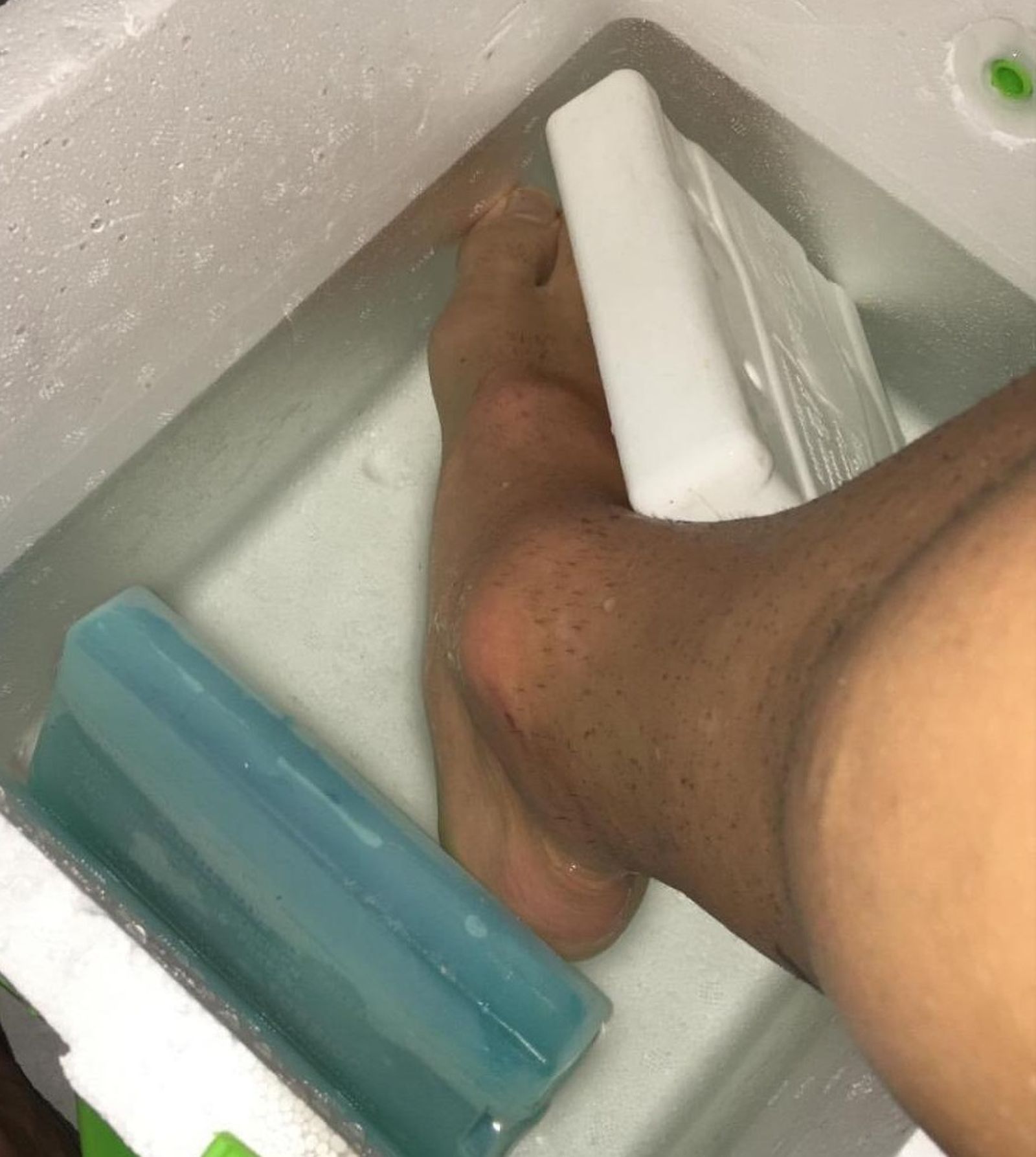 El tobillo de Zafra, inflamado