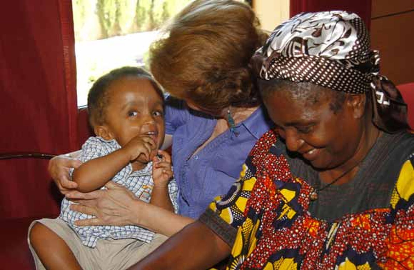 Intervenido con éxito de una hidrocefalia un bebé camerunés