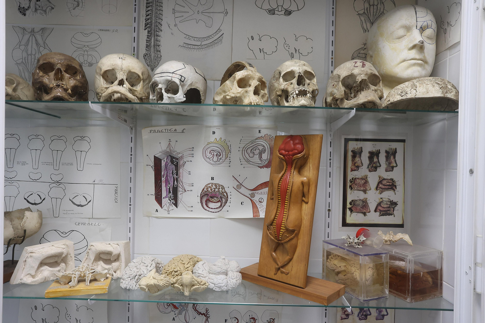 Restauración de esculturas anatómicas usadas con fines docentes entre el siglo XVIII y el XX en la Facultad de Medicina de la US