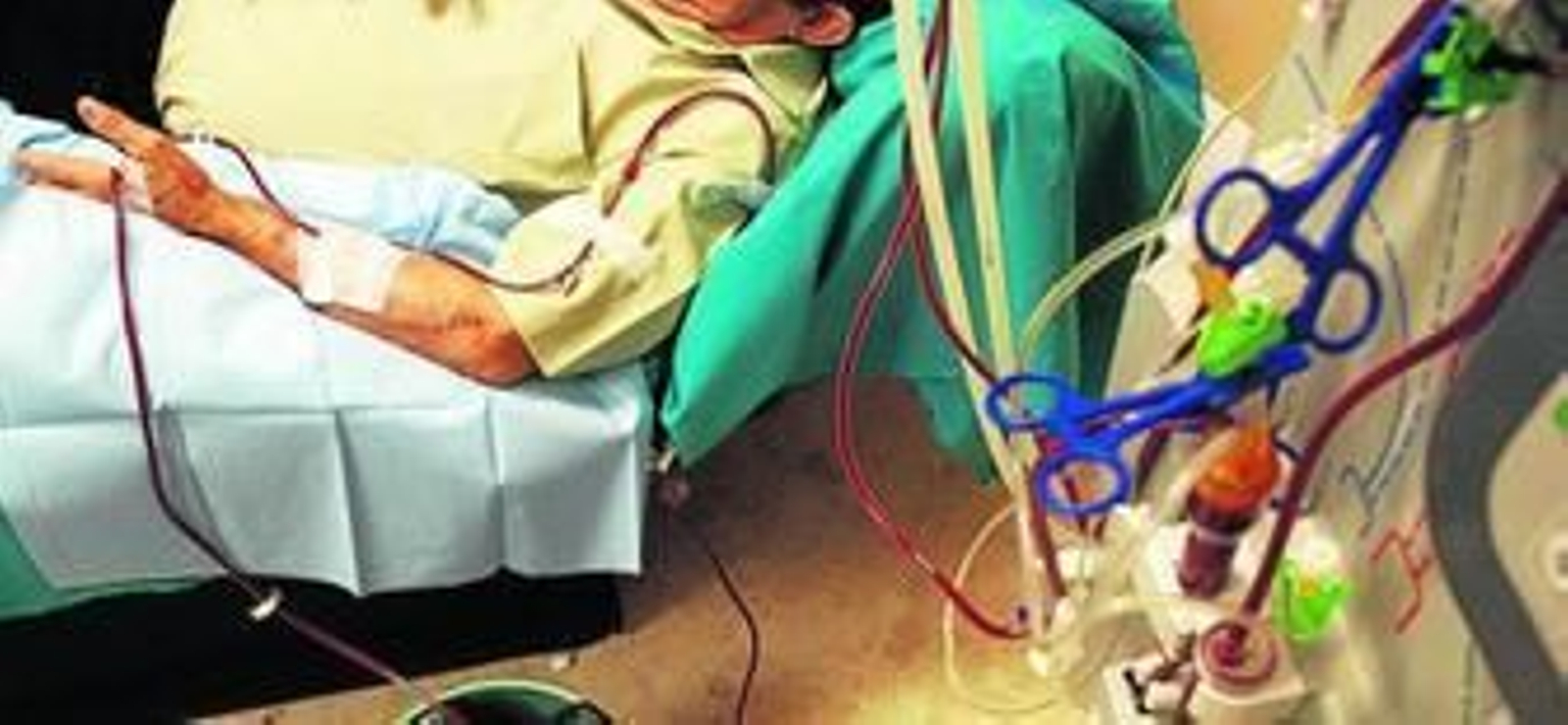 Paciente sometido a una sesión de diálisis.