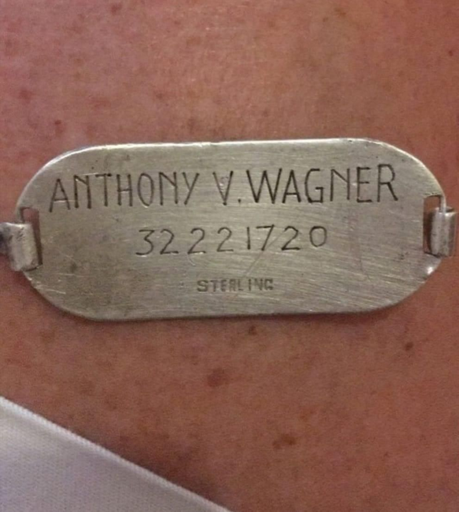 La pulsera de Anthony V Wagner.