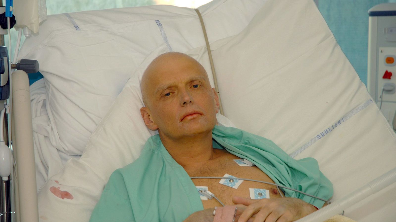 Alexander Litvinenko en el hospital.
