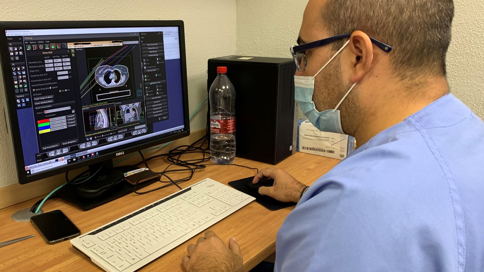 Parte del estudio de simulación para el diseño del tratamiento individualizado.