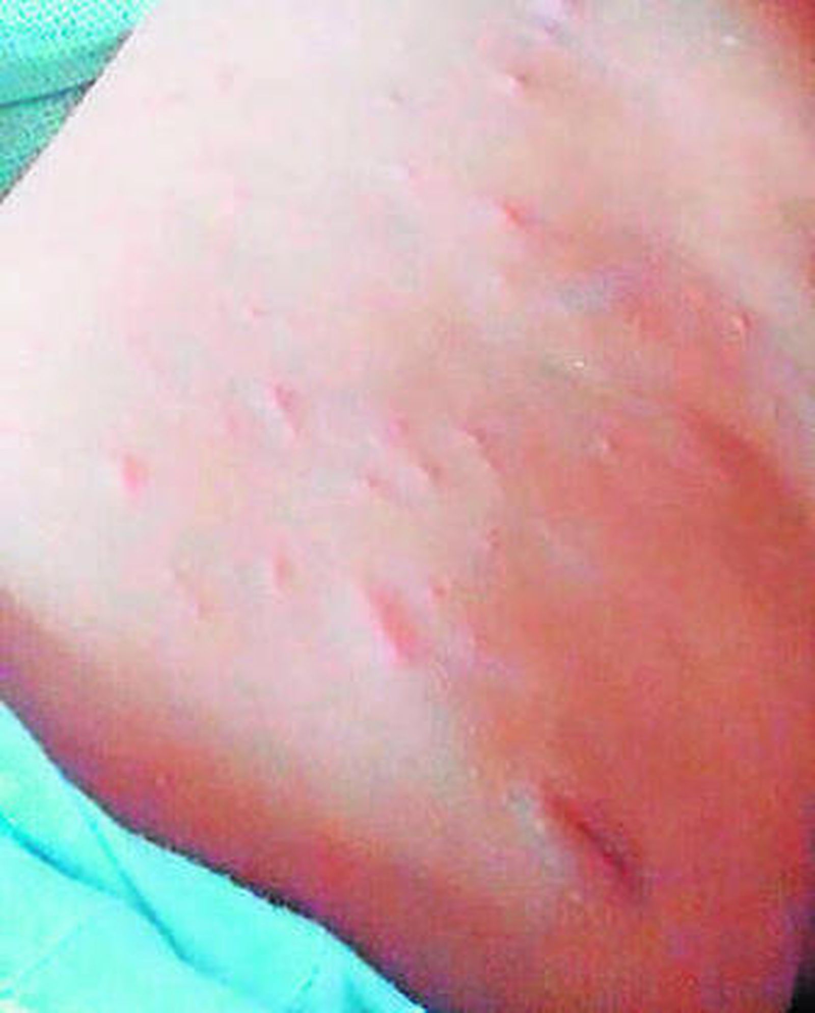 Las continuas plagas dejan vacío el parque periurbano de La Corchuela