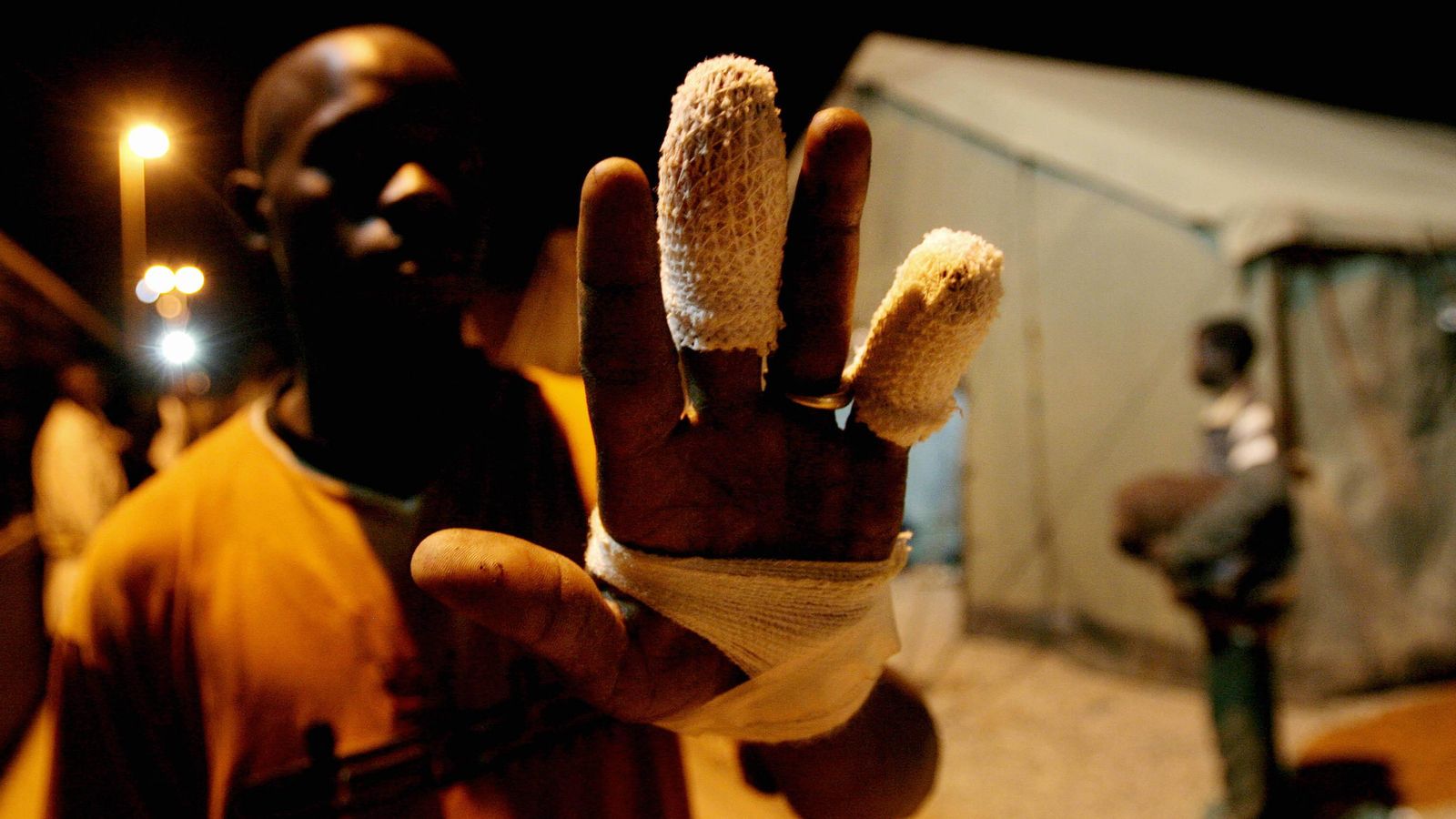 Un inmigrante muestra una de sus manos herida al intentar saltar la valla.