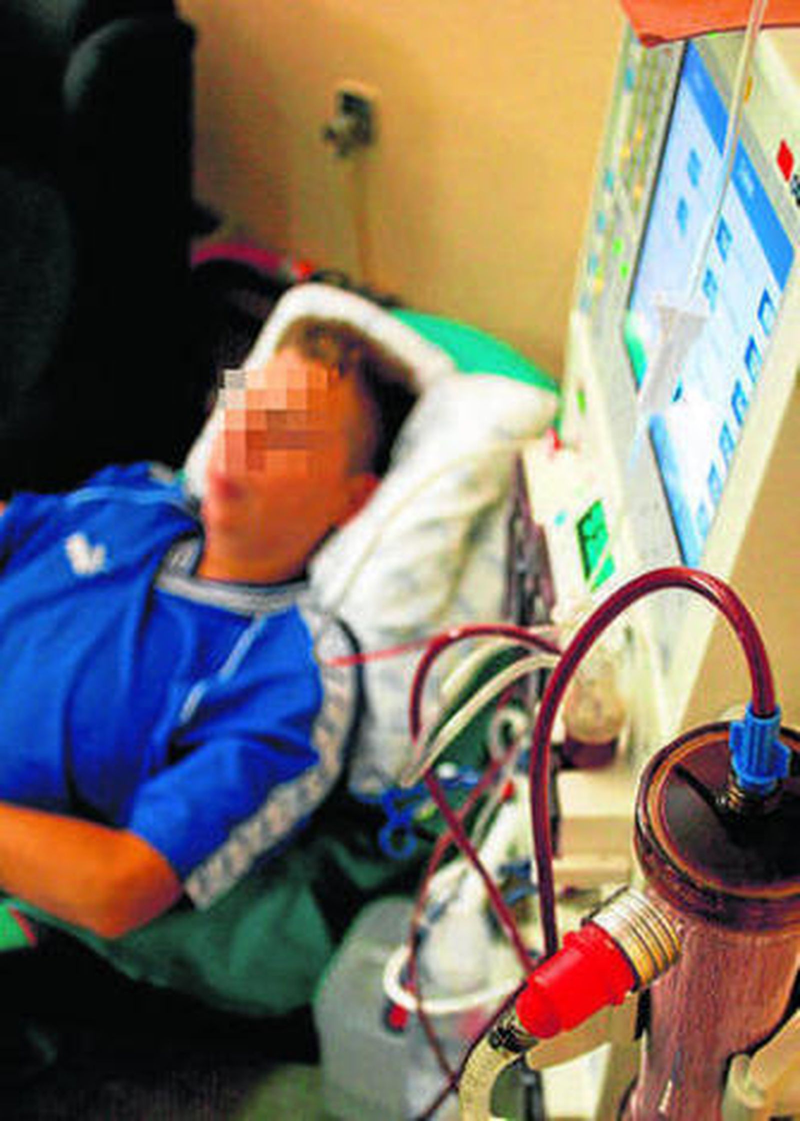 Un paciente en diálisis.