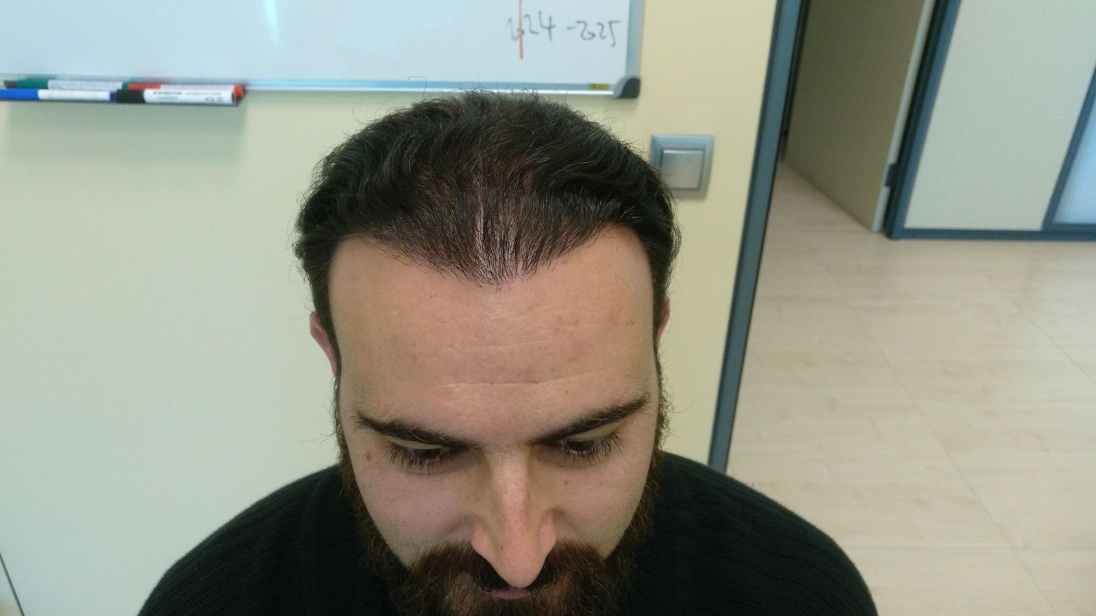 Ayax Ruis después de la operación