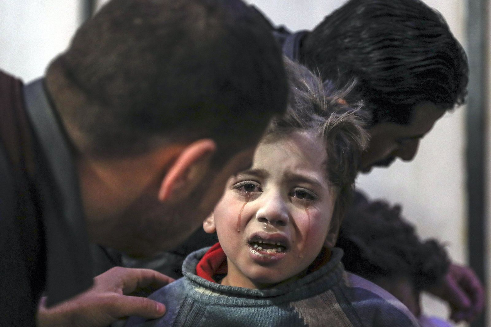 Un niño herido recibe ayuda ayer en un hospital de Douma (Siria).