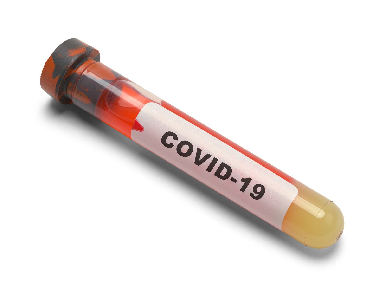 ¿Tiene relación el grupo sanguíneo y el coronavirus?  Qué tipo está más protegido frente al Covid-19