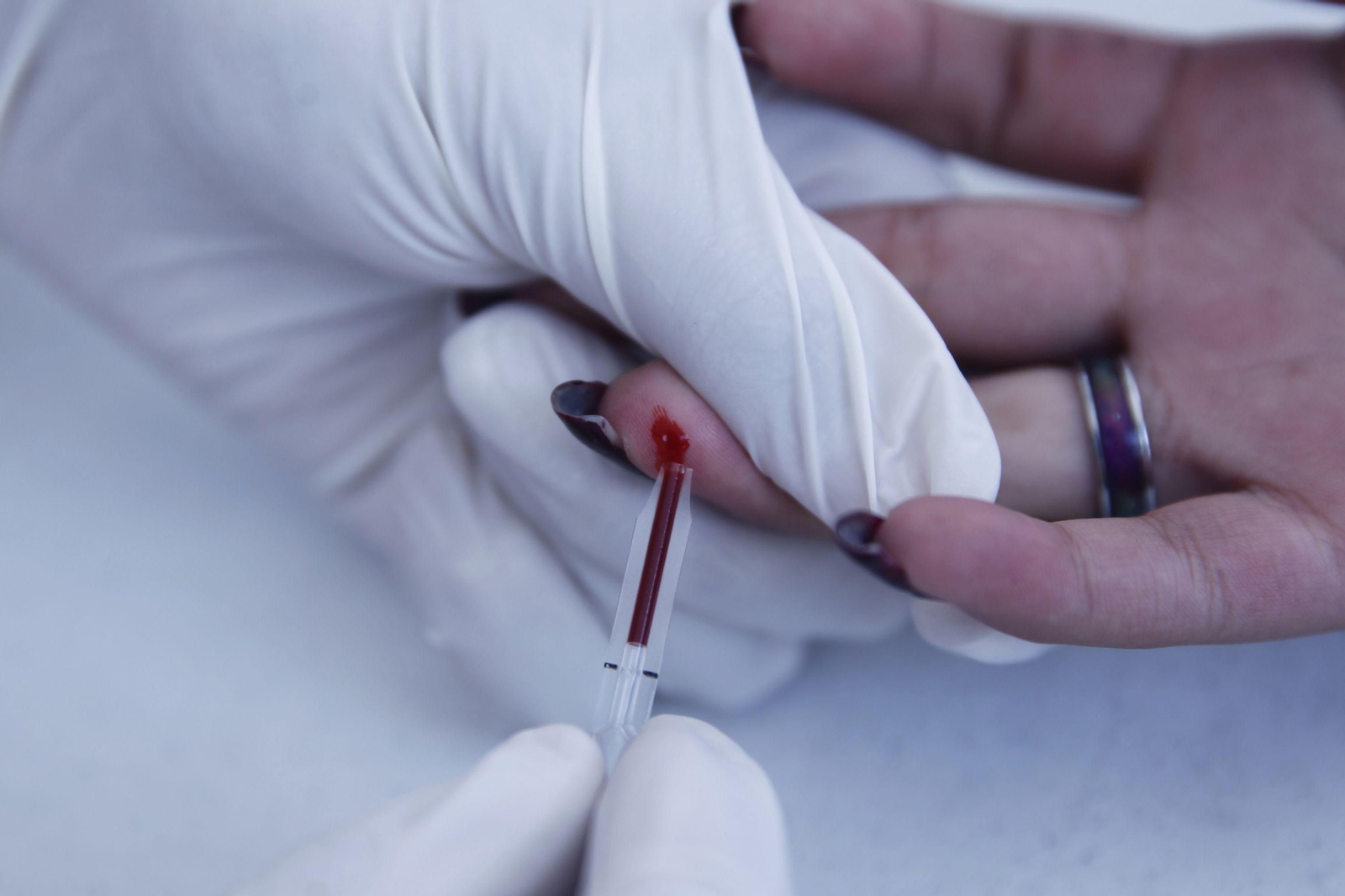 Una persona se realiza una prueba de VIH. Una persona se realiza una prueba de VIH.