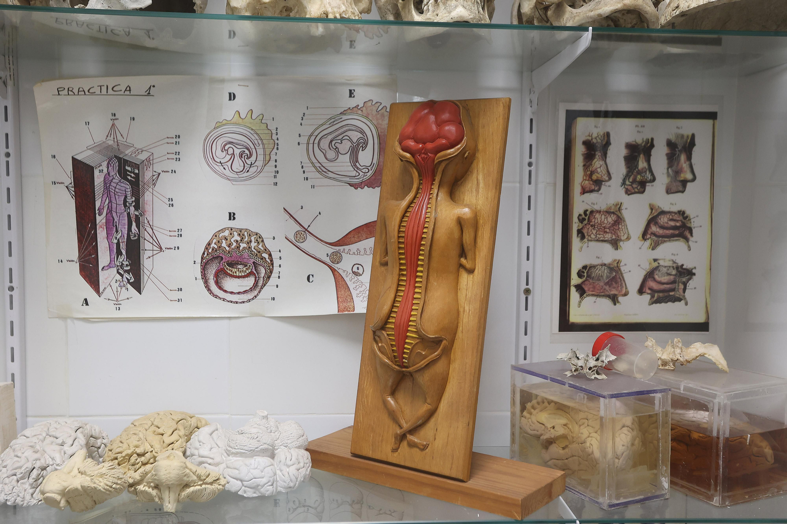 Restauración de esculturas anatómicas usadas con fines docentes entre el siglo XVIII y el XX en la Facultad de Medicina de la US