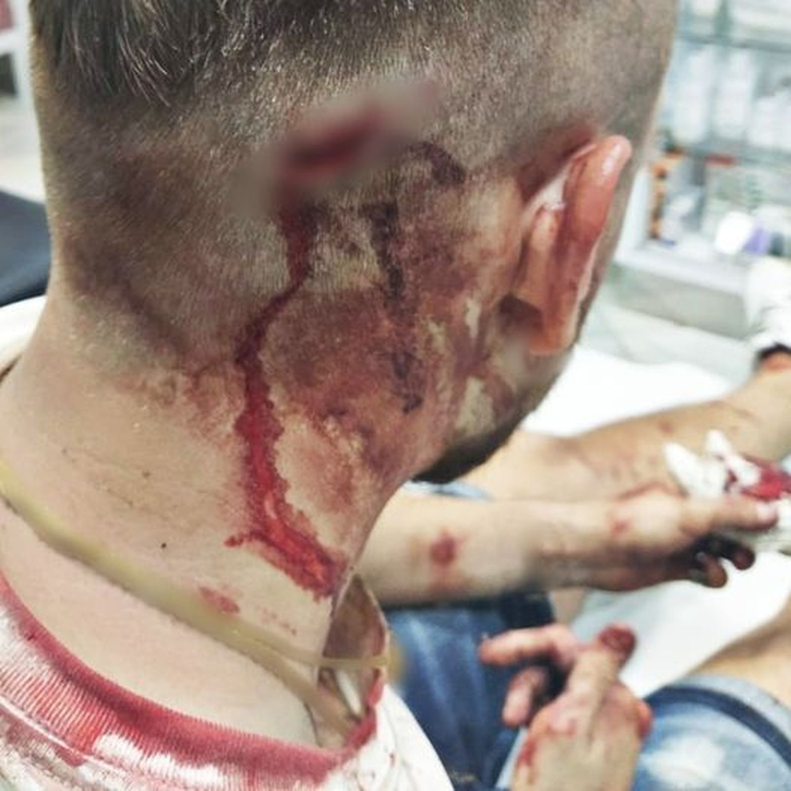 Heridas en la cabeza tras la pelea en Chipiona.