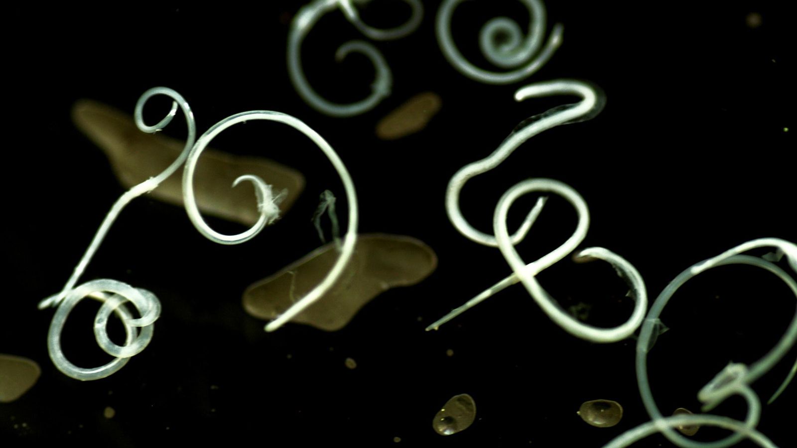 Una imagen de anisakis.