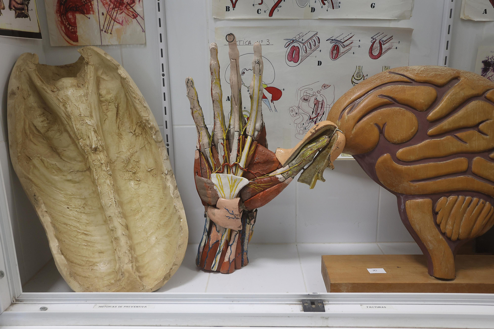 Restauración de esculturas anatómicas usadas con fines docentes entre el siglo XVIII y el XX en la Facultad de Medicina de la US