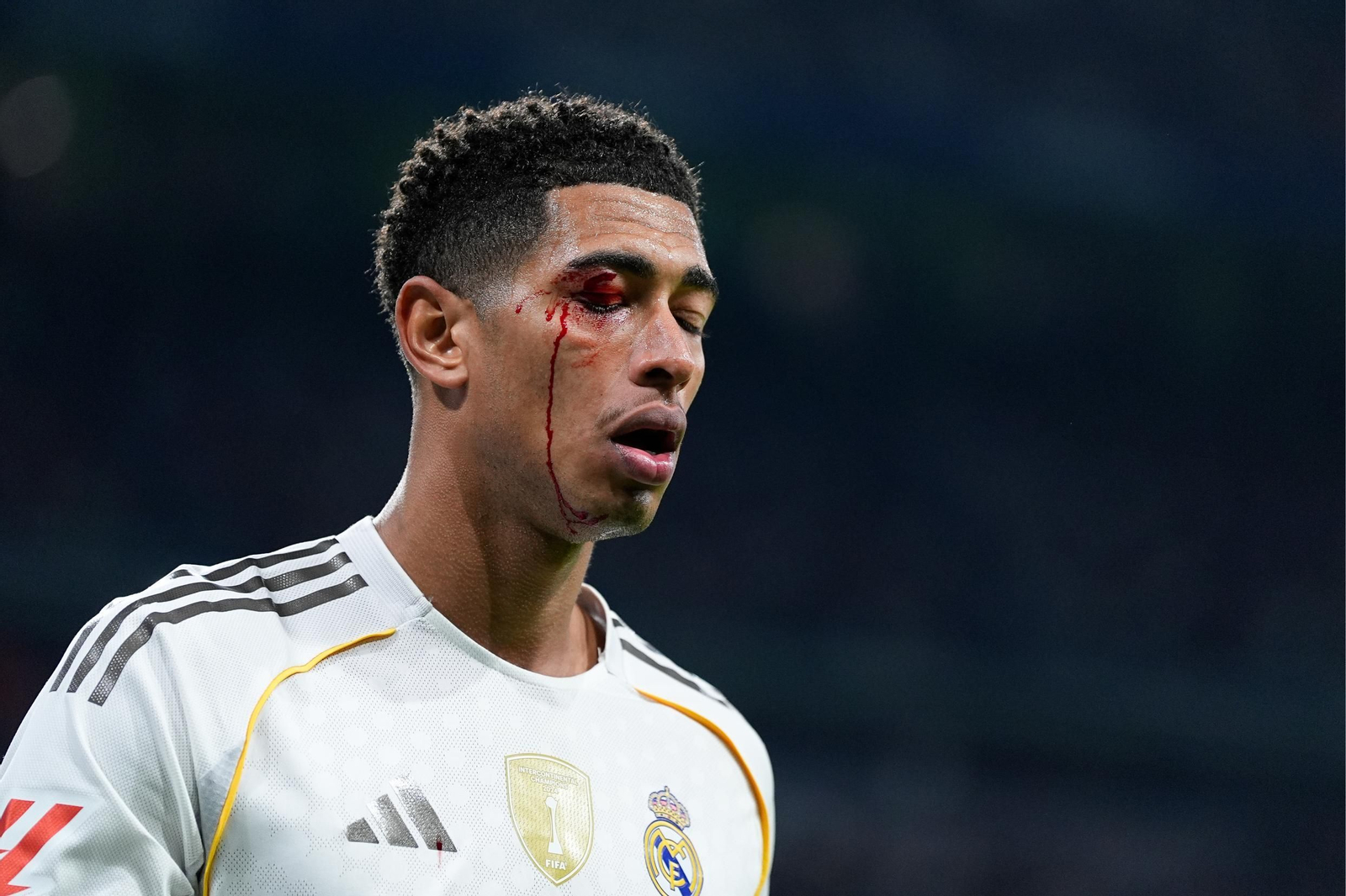 Las fotos de la derrota del Real Madrid contra el Celta