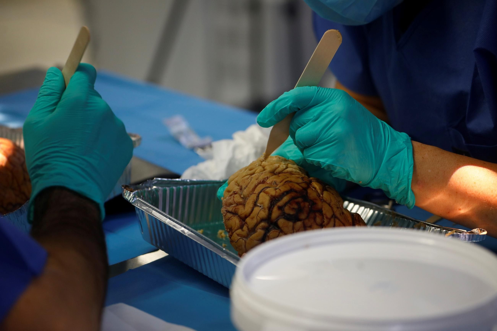 El curso en el que neurocirujanos del Hospital Reina Sofía estudian el cerebro, en imágenes