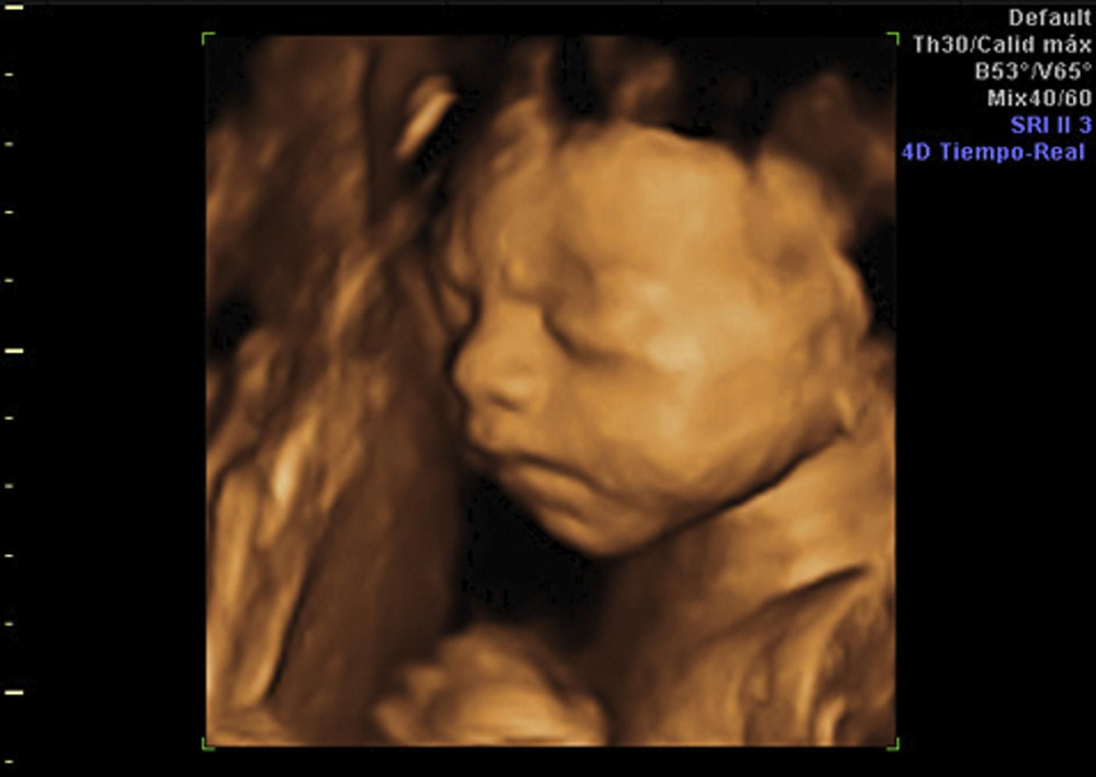 Una ecografía 4D.