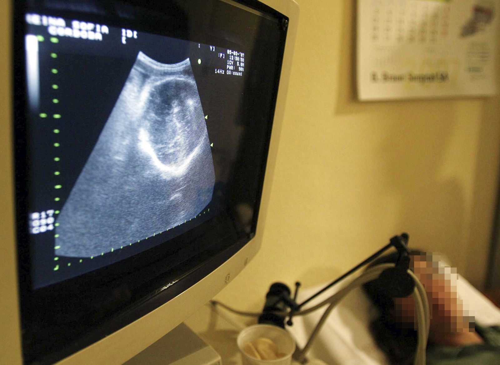 Primer plano de una ecografía en una imagen de archivo.