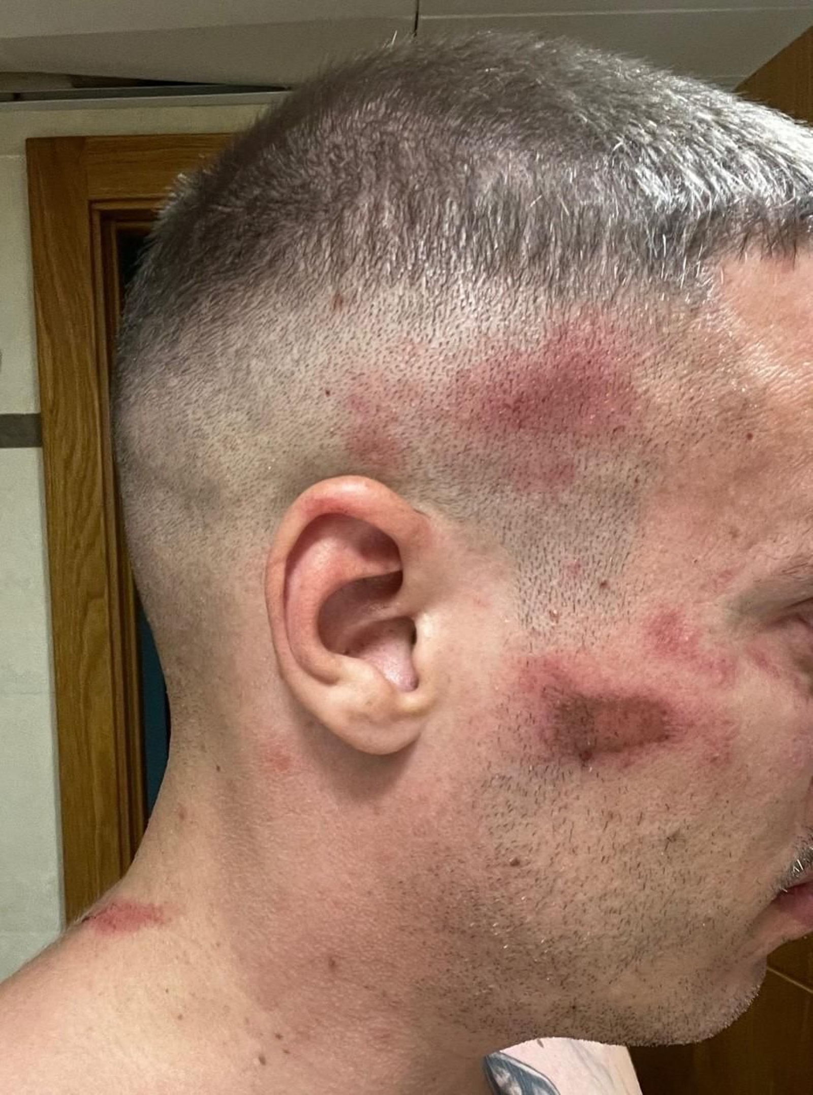 Lesiones en la cara, producidas supuestamente por la agresión de los policías.