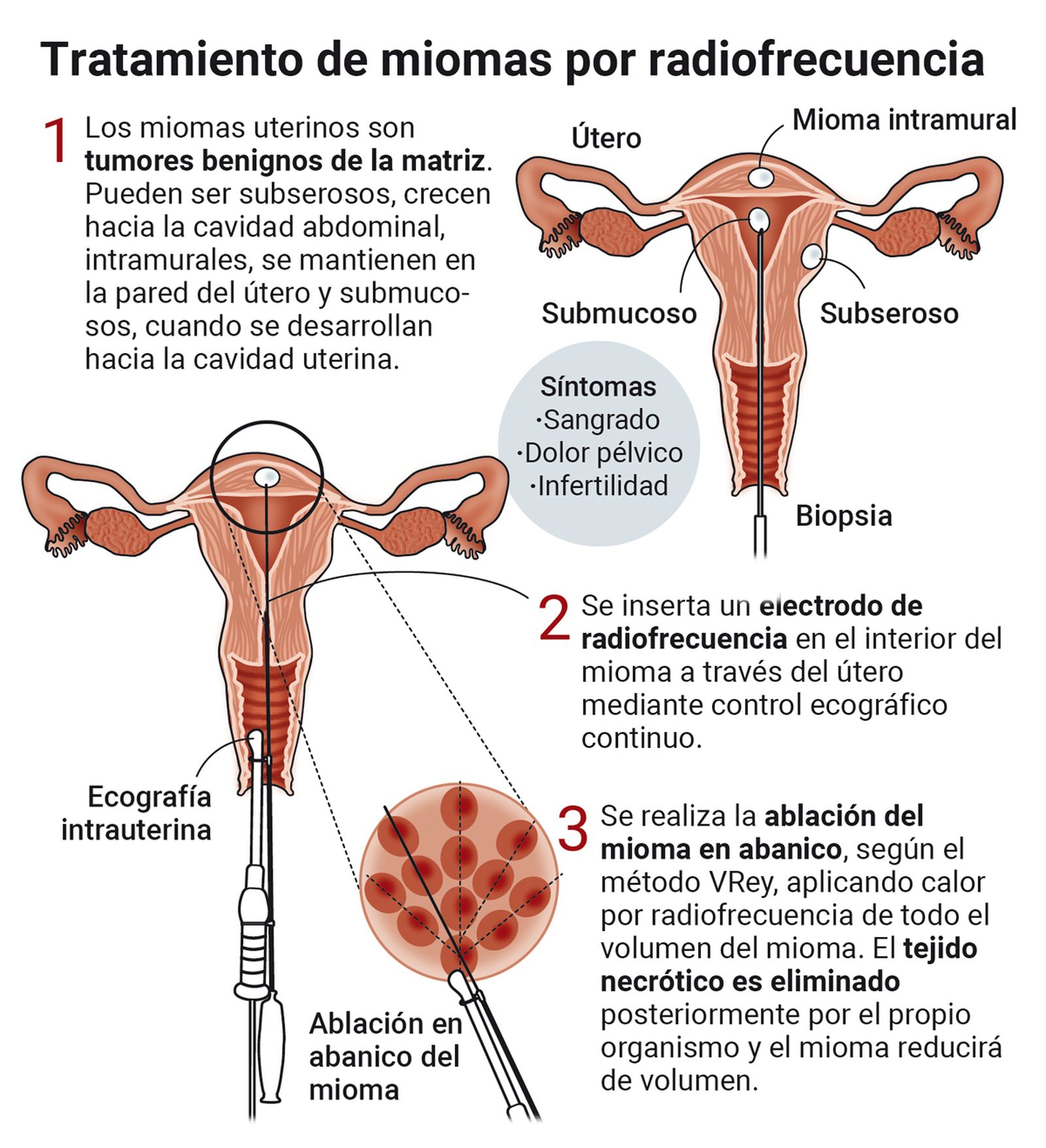 Fuente: Clínica Victoria Rey. Gráfico: Dpto. de Infografía