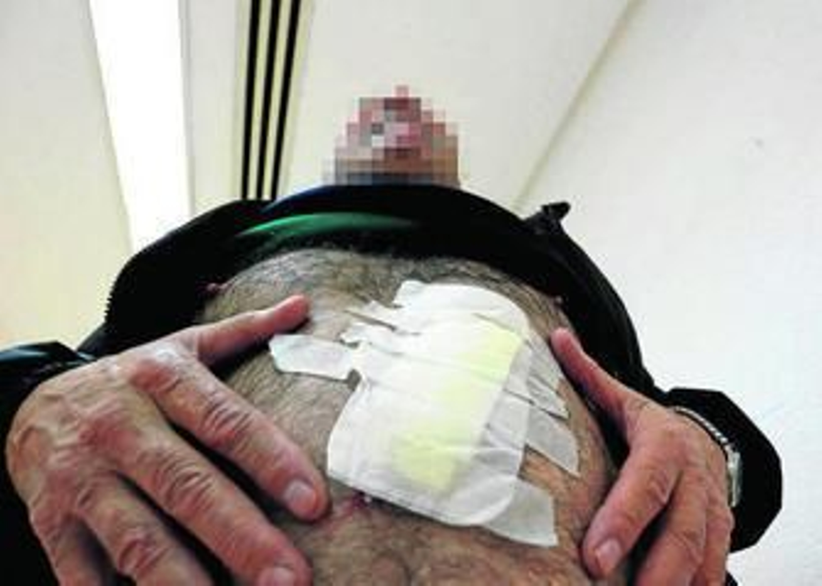 El agente retirado muestra las heridas que dijo que le causaron cuando evitó el ataque de yihadistas.