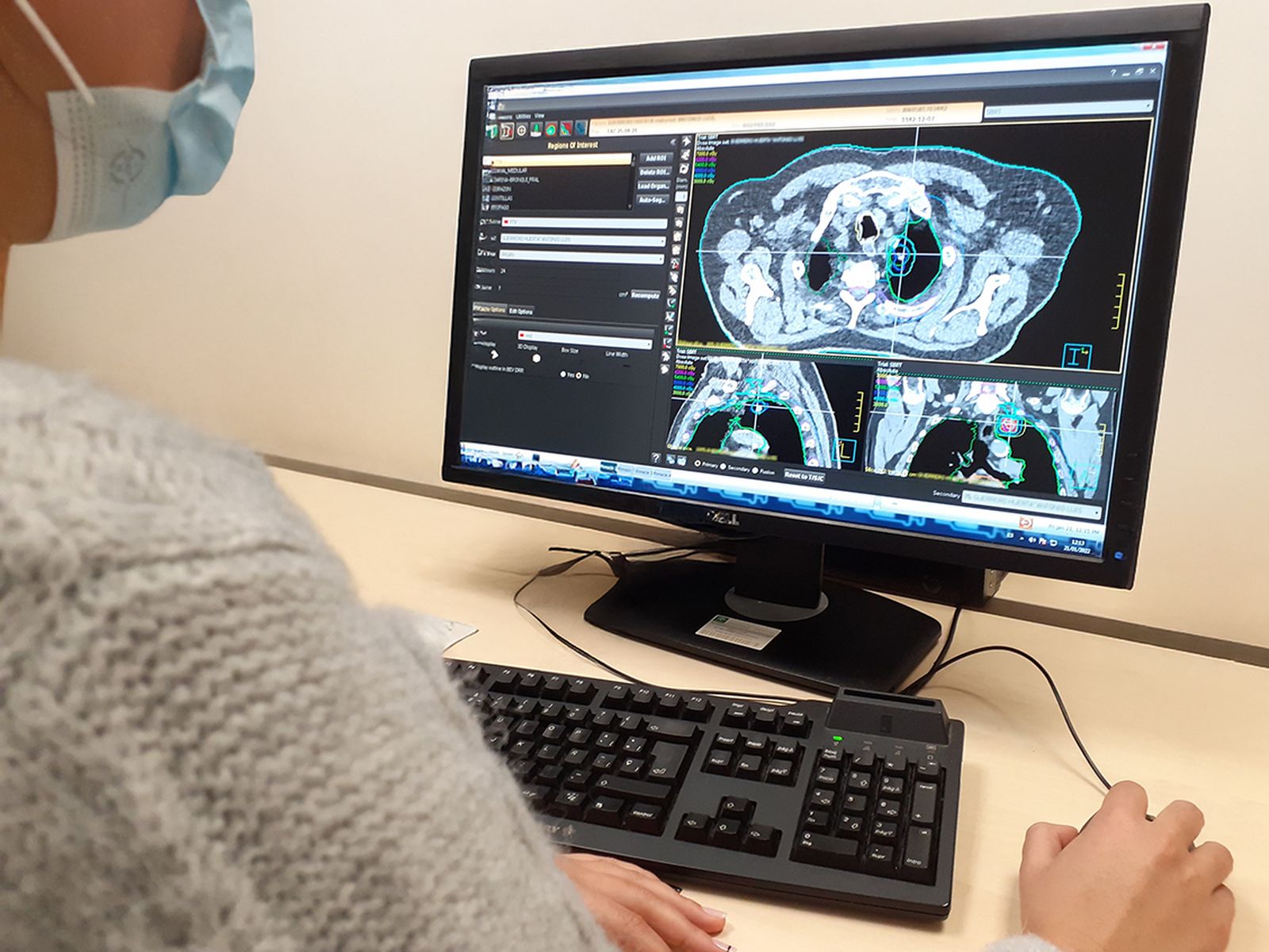 Una oncóloga observa las imágenes tomadas por SBRT.
