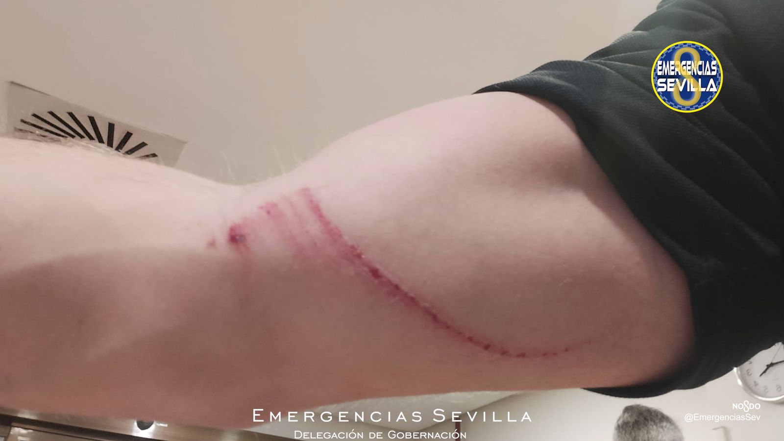 Una de las heridas causadas al agente.