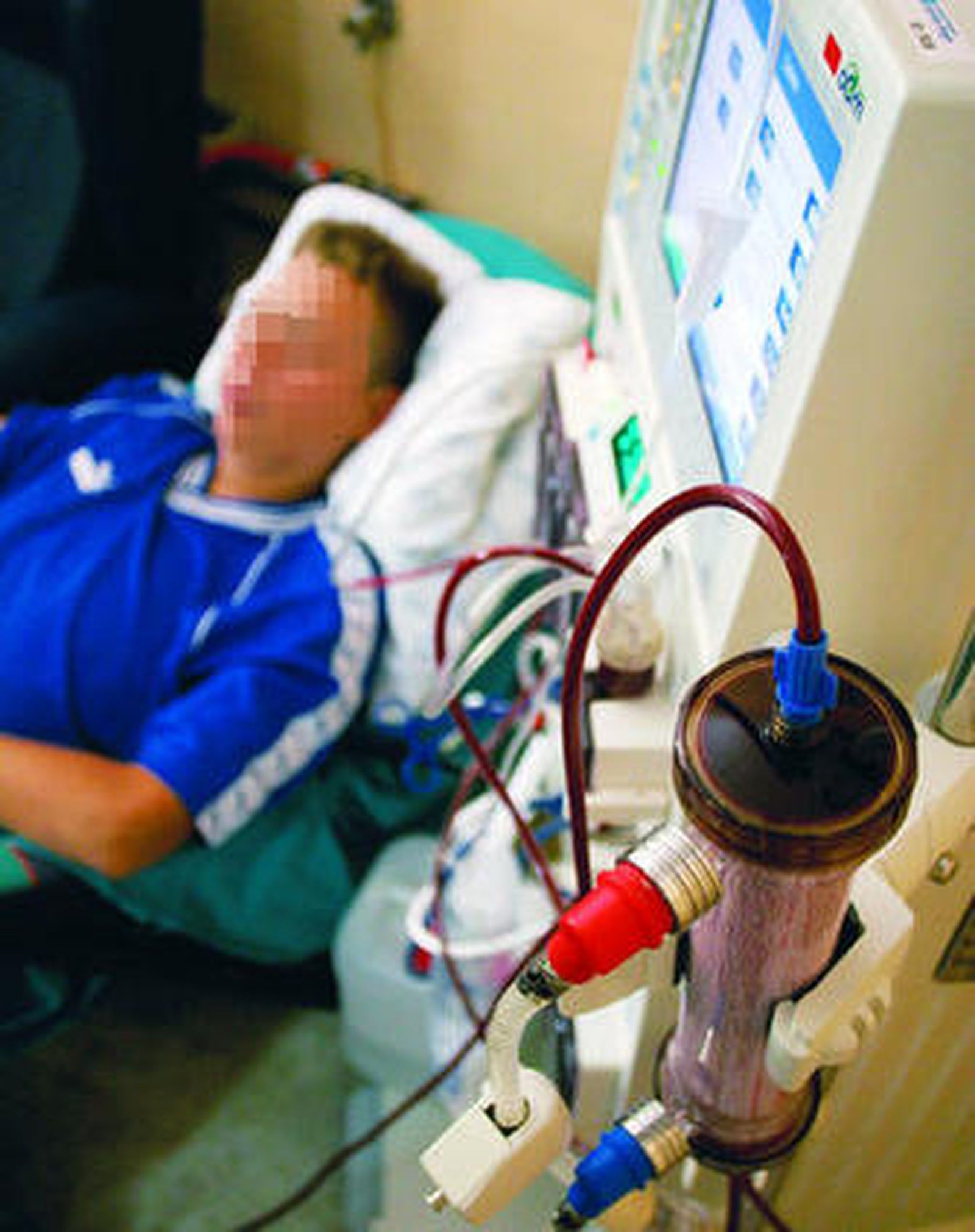 Un enfermo malagueño durante una sesión de diálisis, en una imagen de archivo.