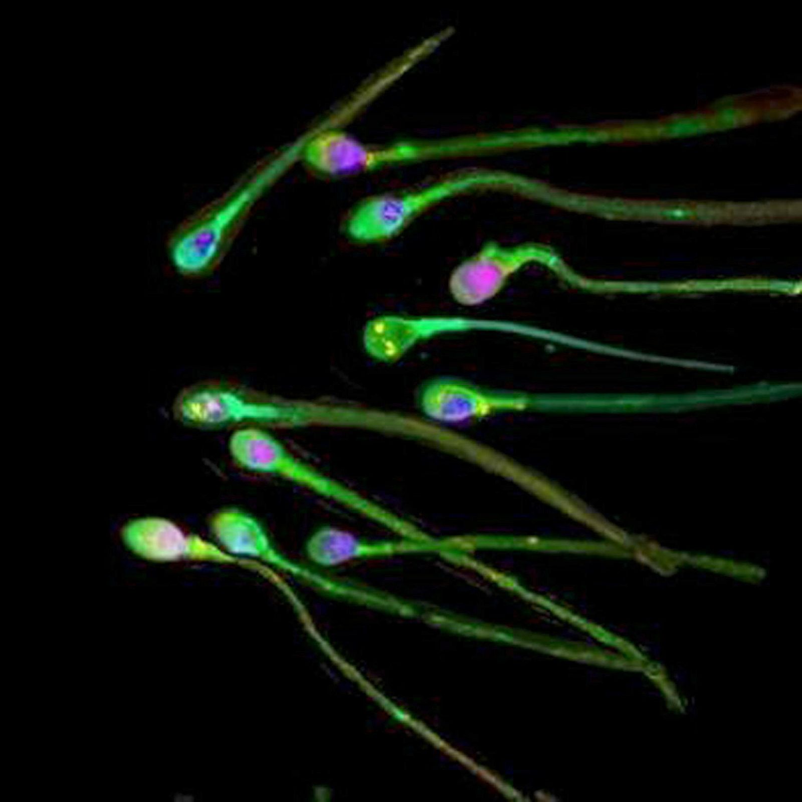 Cadena de espermatozoides