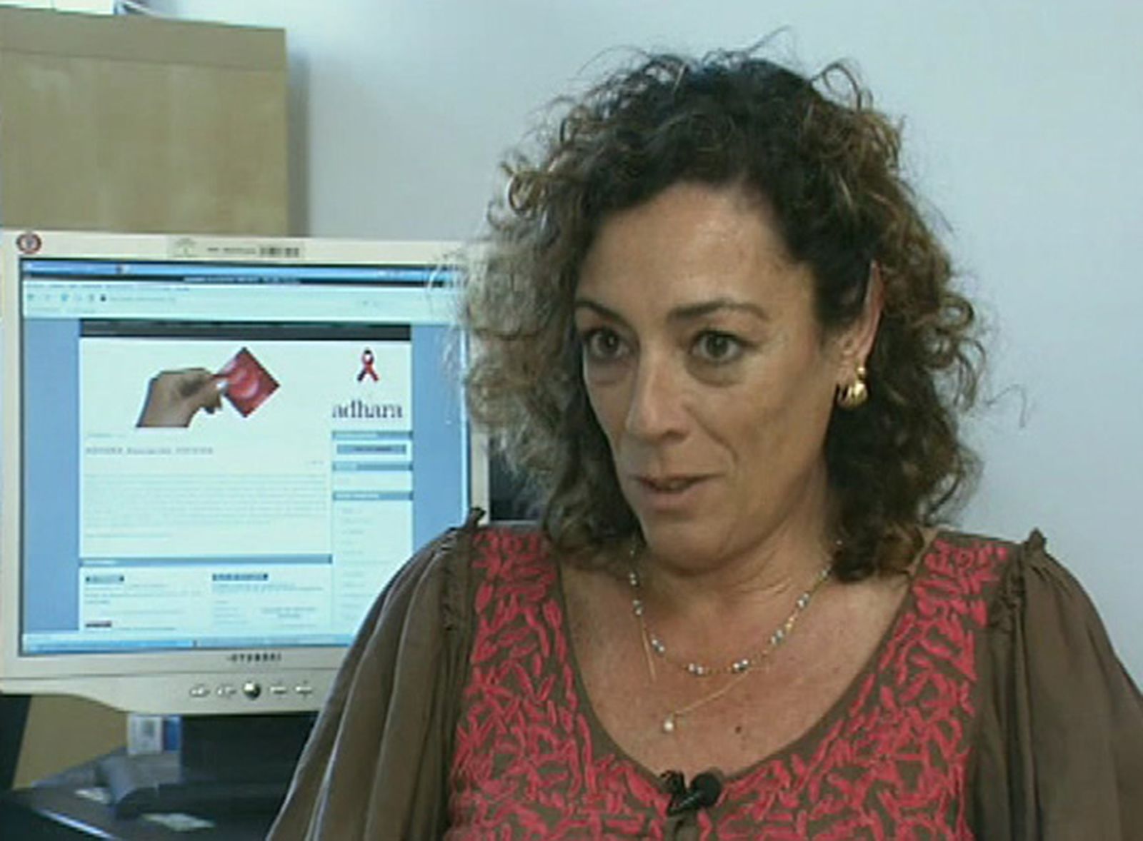 Pasado, presente y futuro de la lipodistrofia en pacientes con VIH