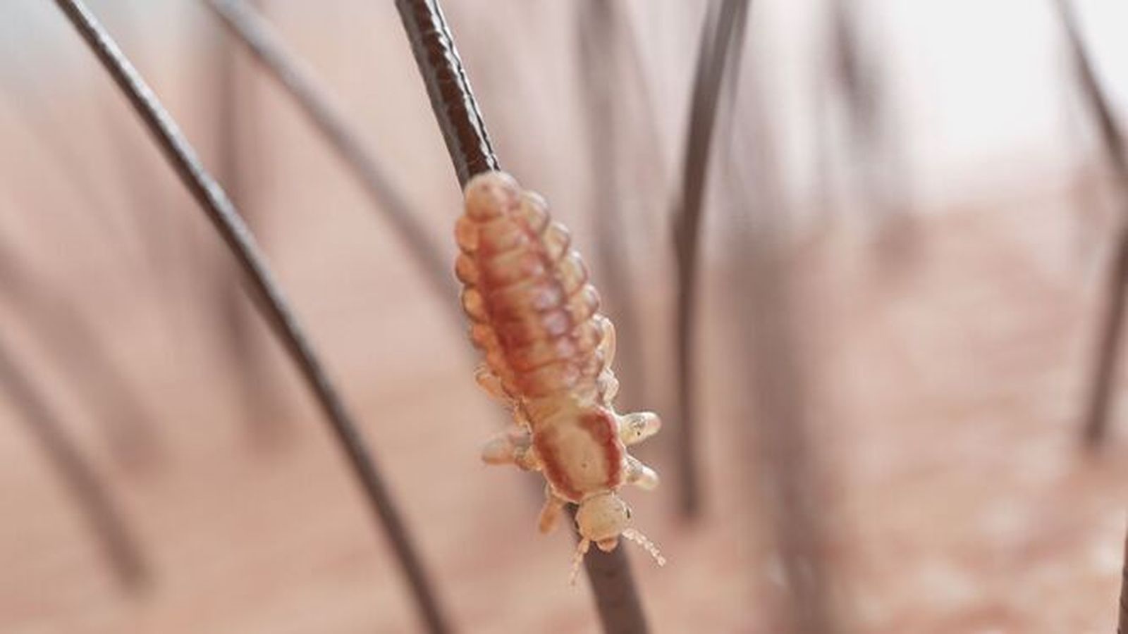 Mitos sobre los piojos que son falsos