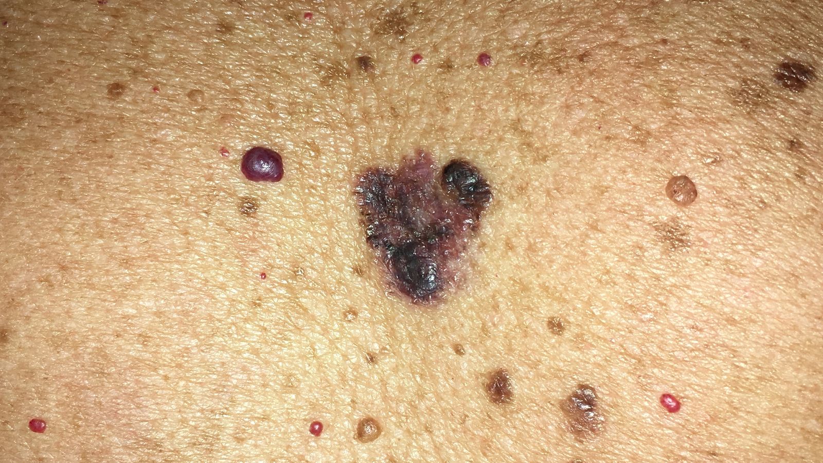 Detalle de una lesión cutánea.