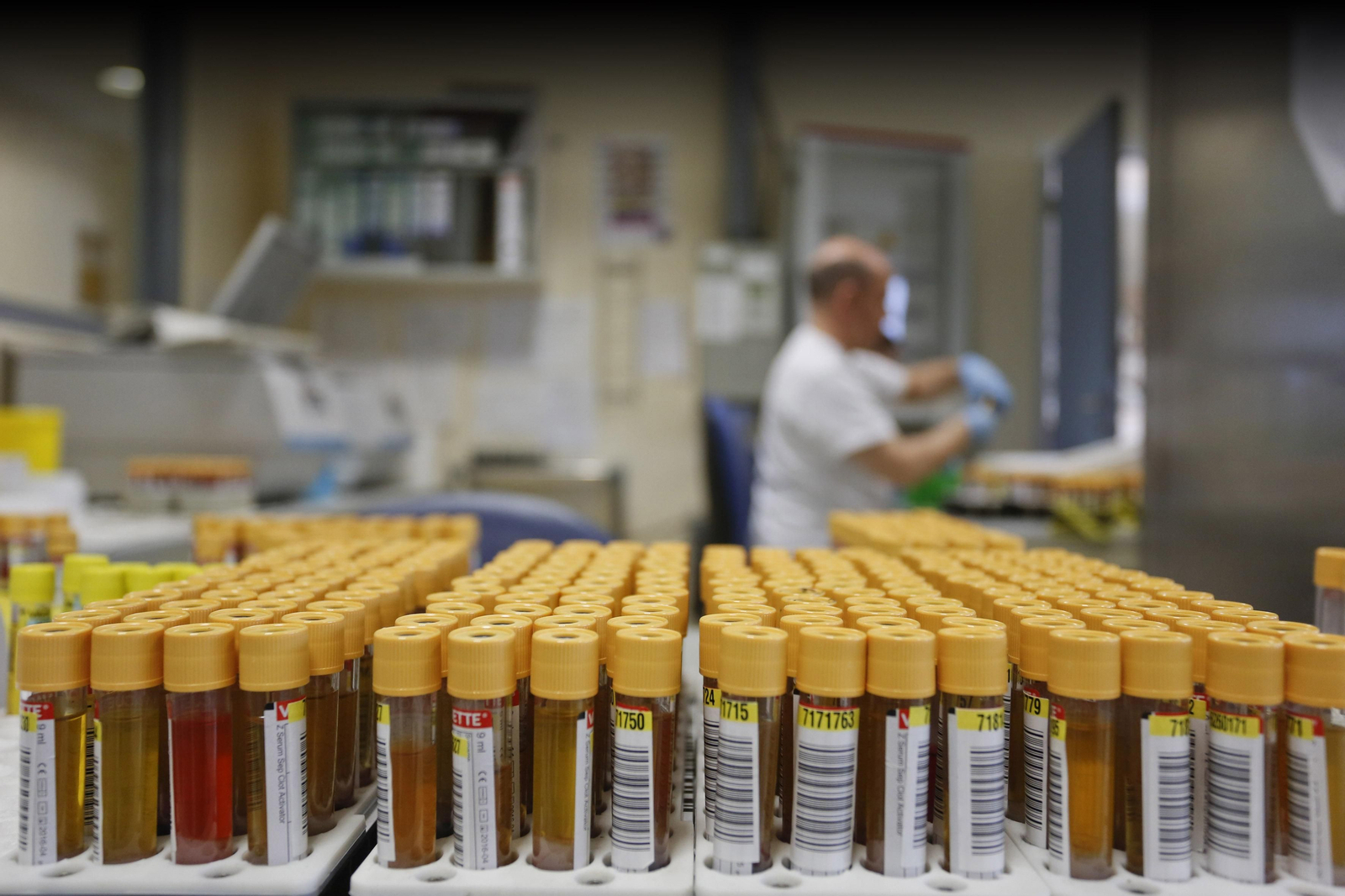 Muestras para procesar en un laboratorio en una imagen de archivo.