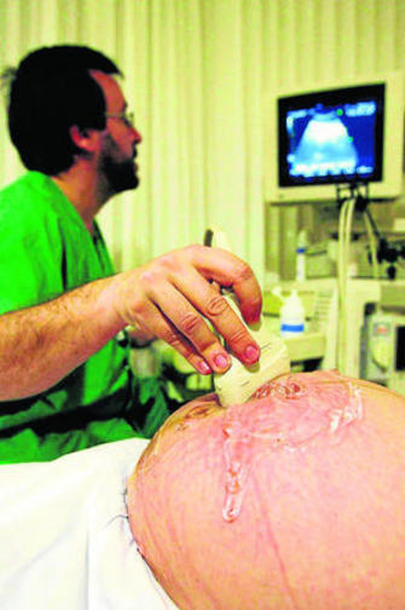 Una mujer embarazada a la que realizan un ecografía.