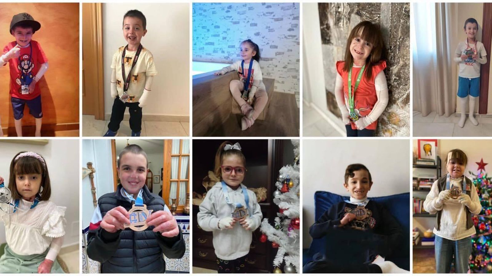 Niños del #RetoPichon con Piel de Mariposa.