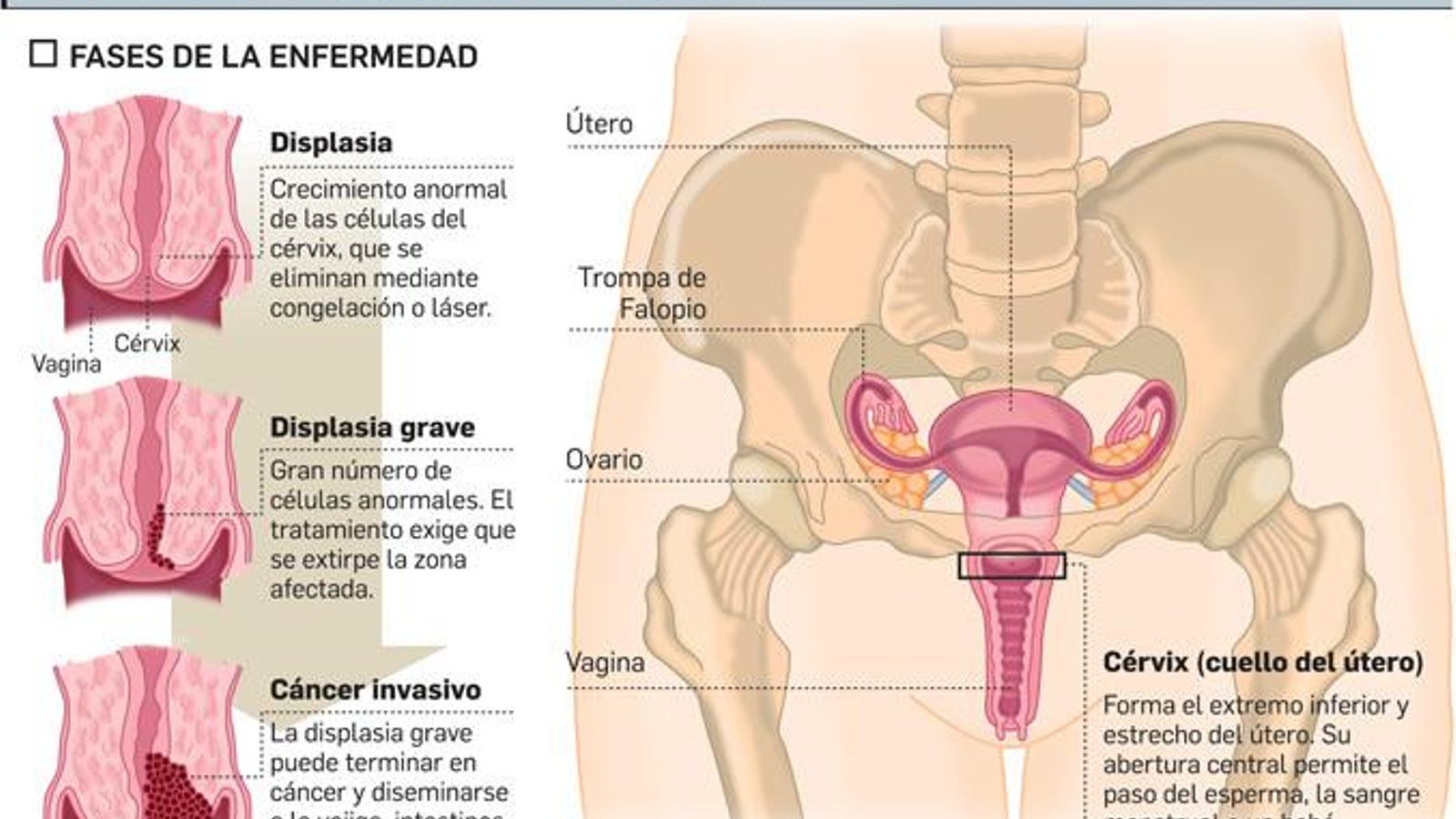 FUENTE: Instituto Carlos III y SAS. GRÁFICO: Dpto. de Infografía.