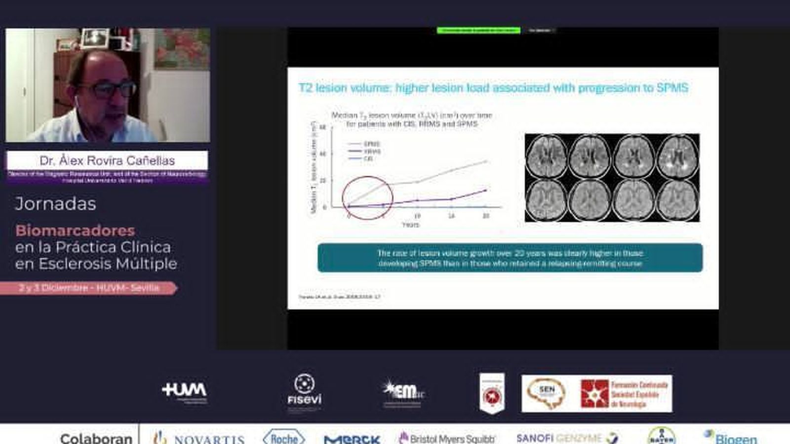 Jornadas biomarcadores esclerosis multiple.