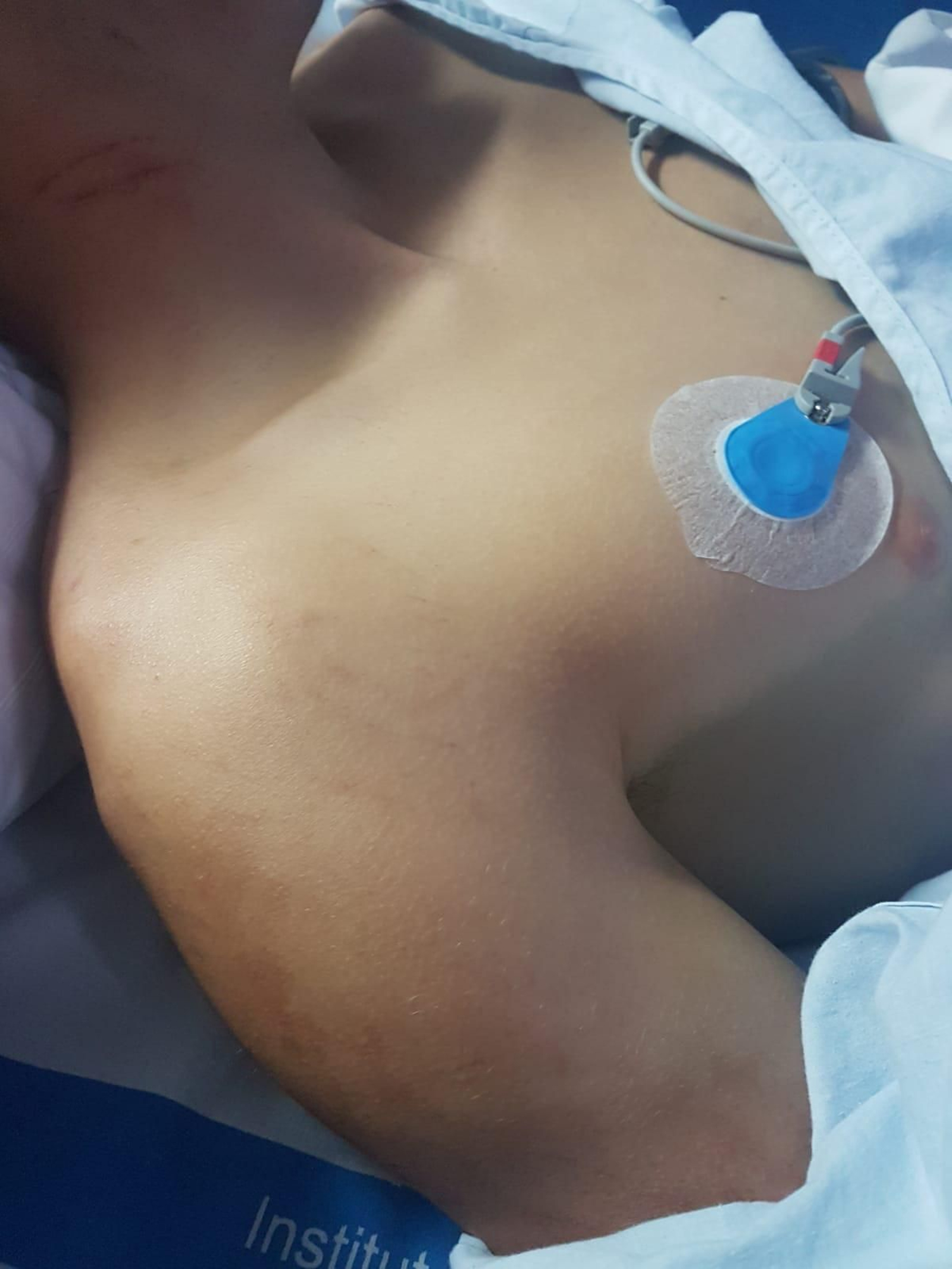 Estado del menor tras la paliza de unos policías en Melilla