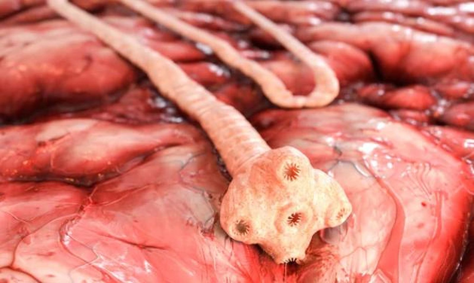 Los huevos de tenia para adelgazar:  lo que debes saber sobre esta práctica peligrosa con efectos potencialmente mortales