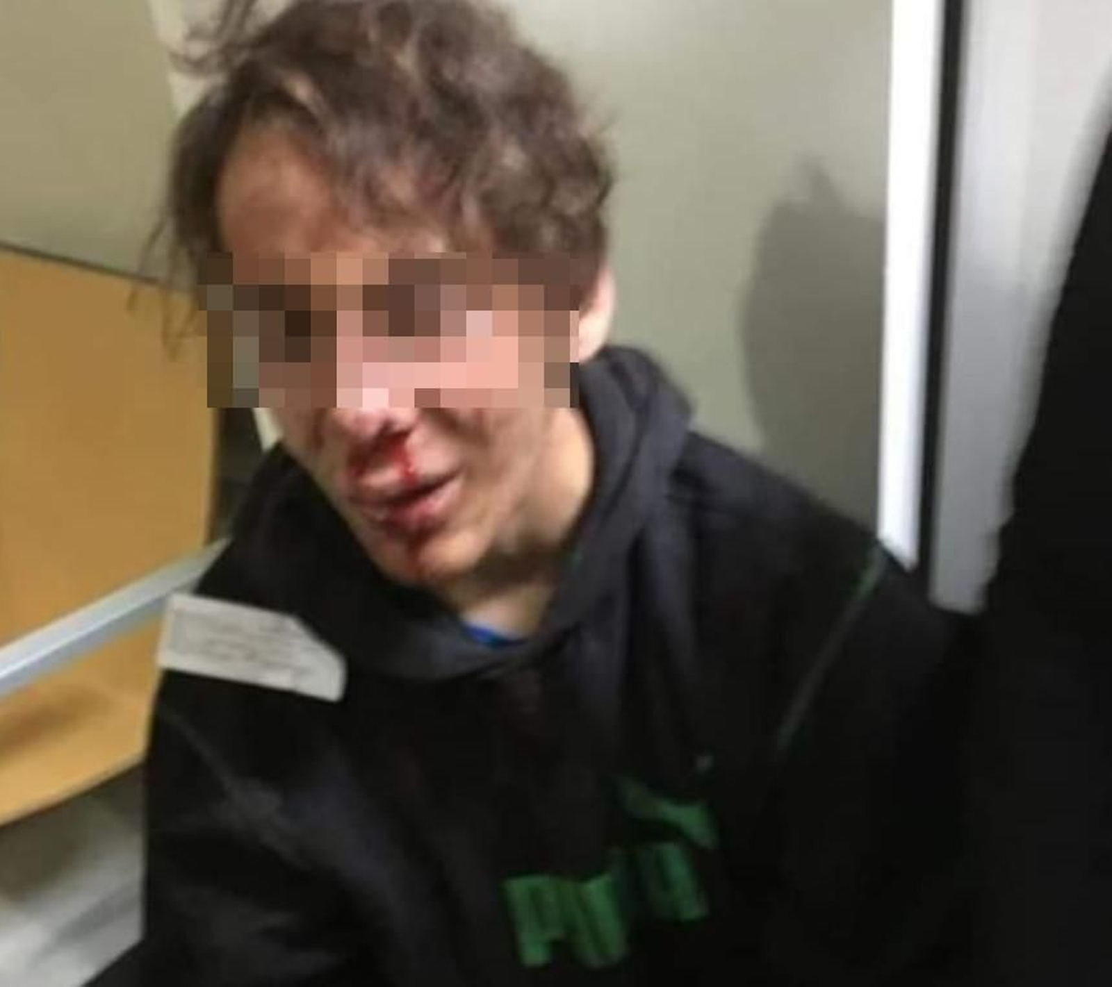 Estado del menor tras la paliza de unos policías en Melilla