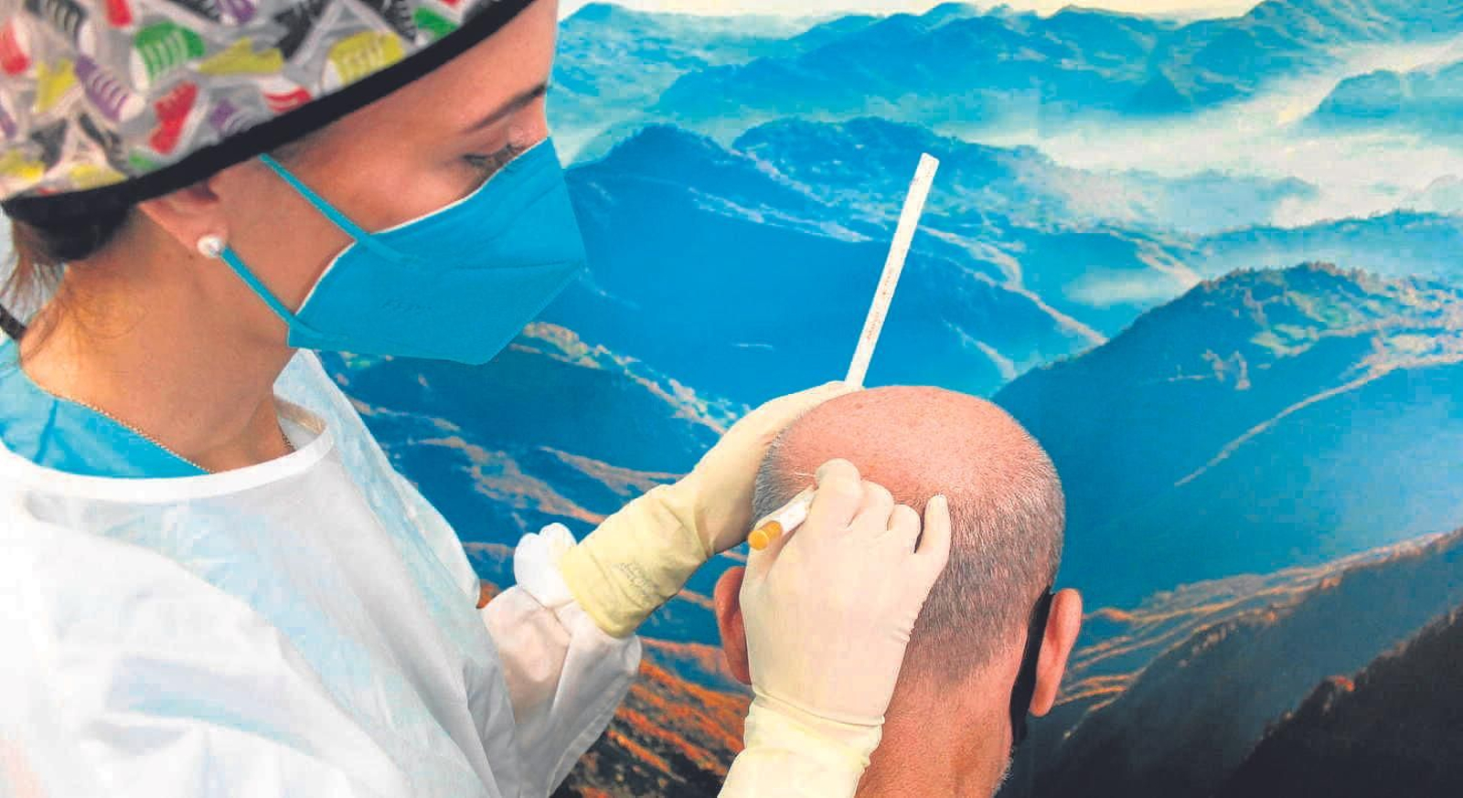 Beiman Capilar llega a Granada con el equipo líder de microinjerto en Andalucía oriental