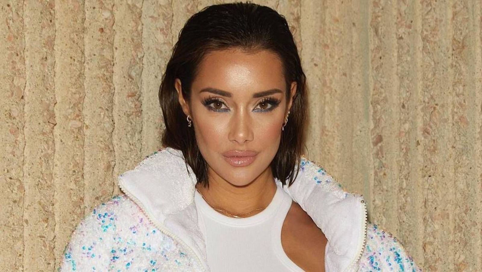 Adara Molinero ha sufrido quemaduras de segundo grado en sus piernas tras una intervención estética.