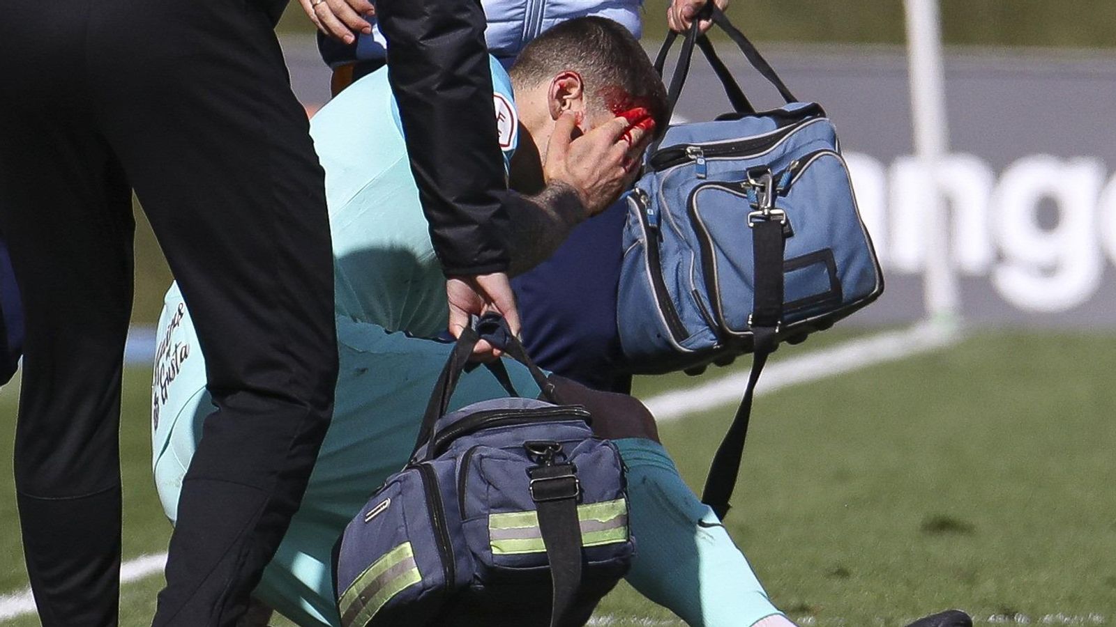 Eric Montes, con la cara y las manos ensangrentadas tras el golpe.