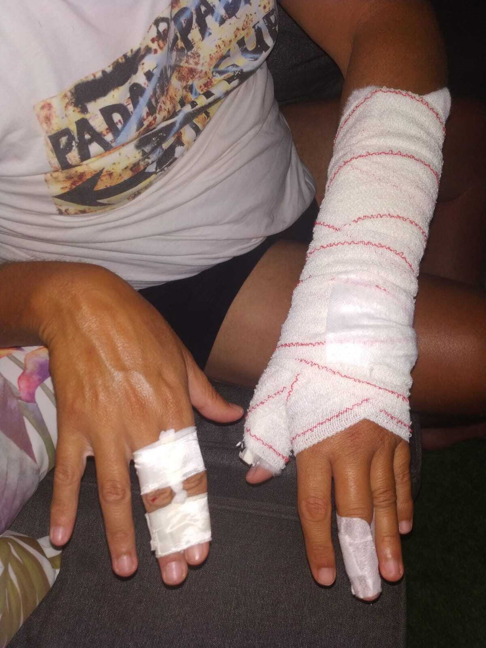 El funcionario lesionado al reducir a un preso de Alhaurín de la Torre