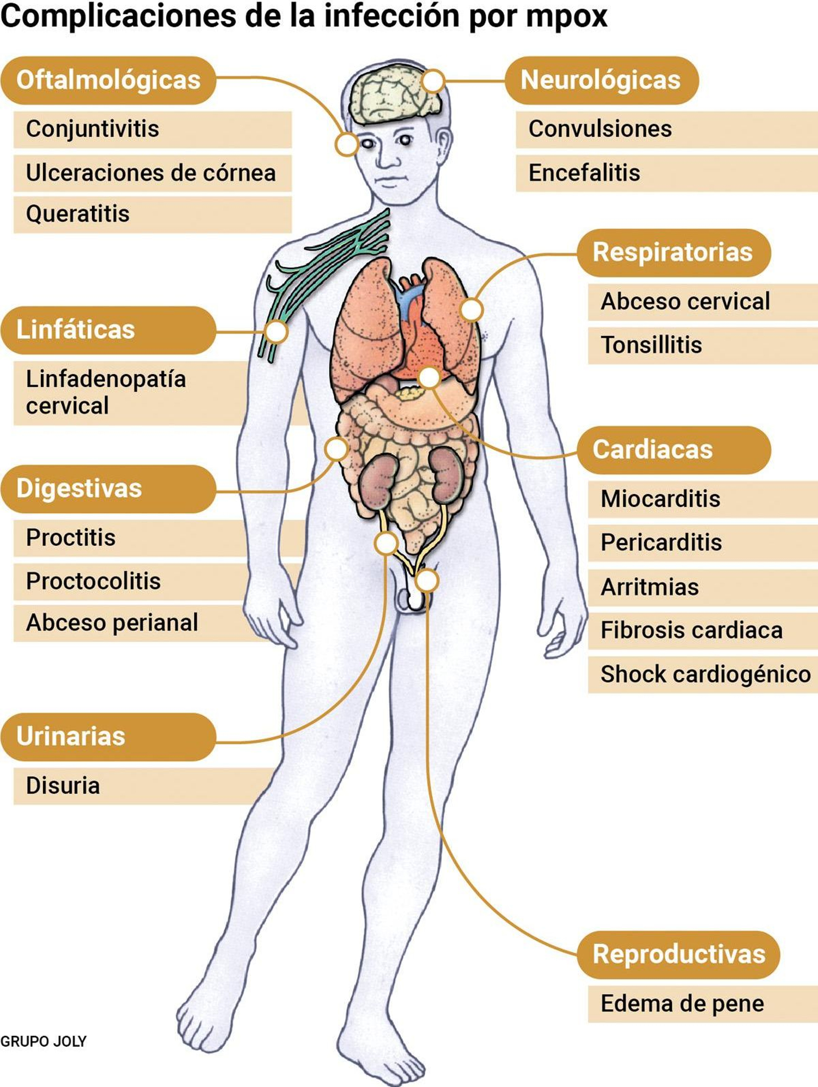 Complicaciones de la viruela del mono en personas con patologías. Fuente: Organización Mundial de la Salud.