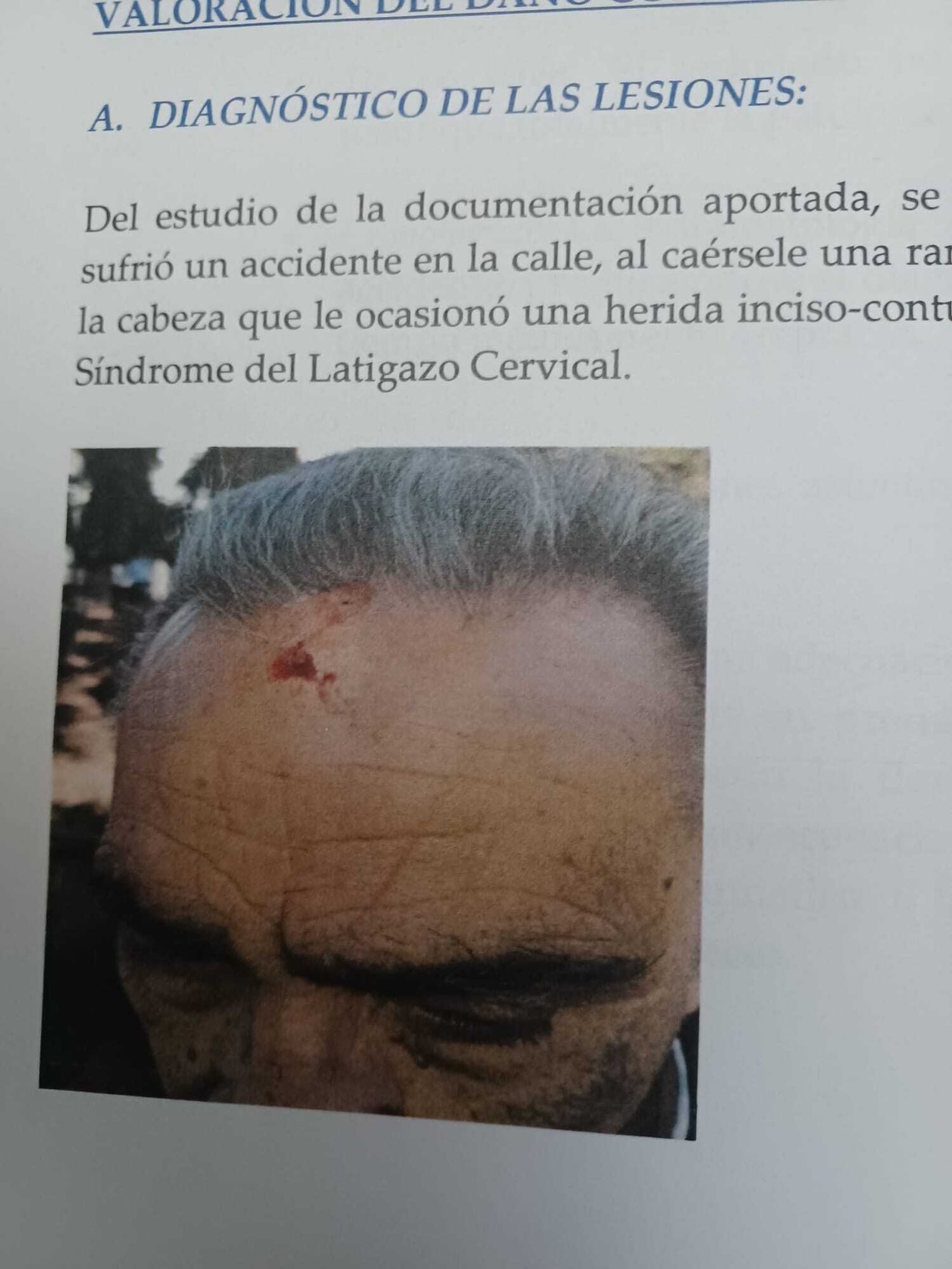 Un detalle de las lesiones que sufrió la víctima.