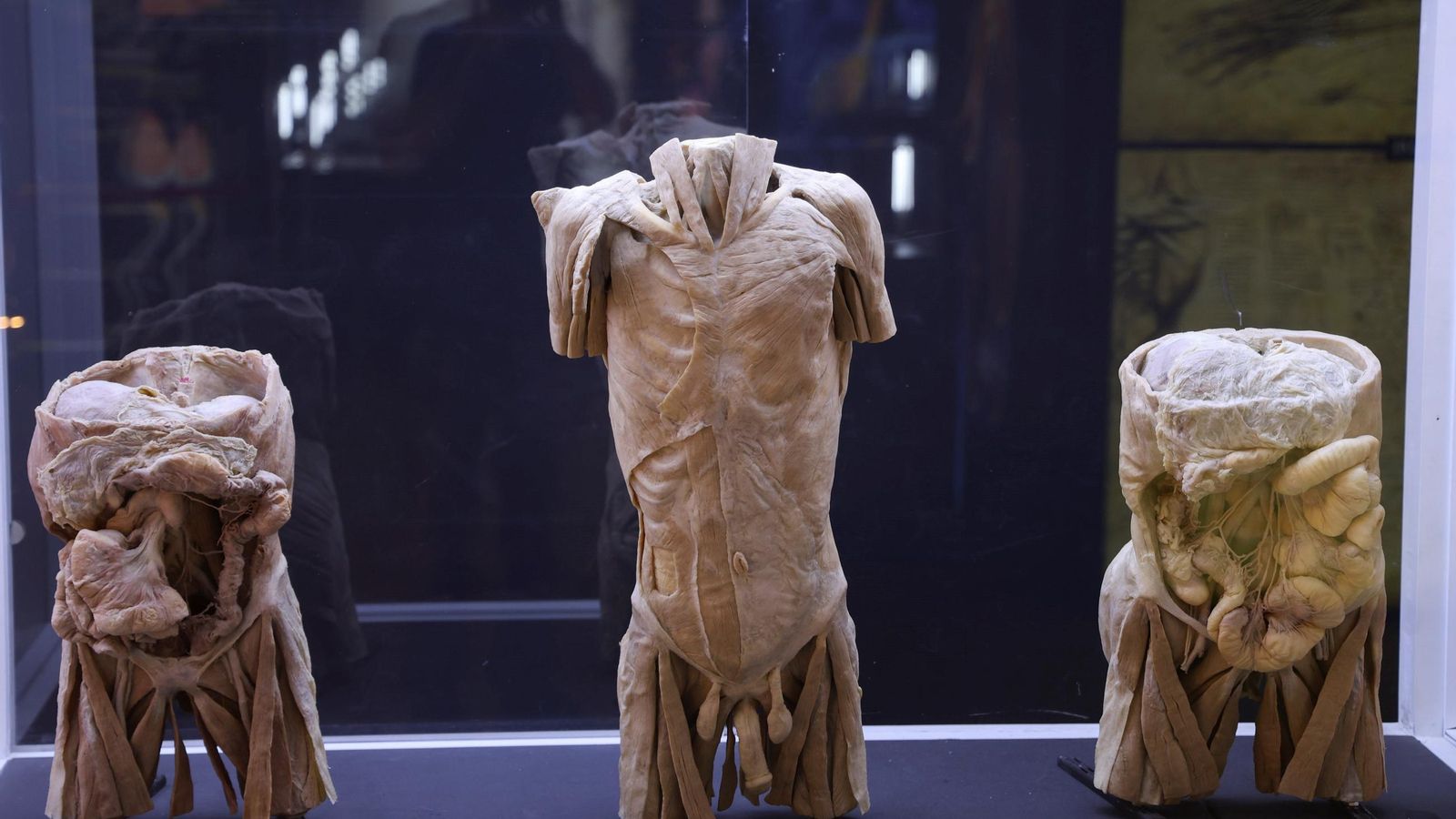 La exposición exhibe ocho cuerpos reales y más de 100 órganos. La exposición exhibe ocho cuerpos reales y más de 100 órganos.